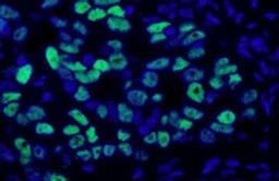 Detection of human p53 by immunofluorescence.