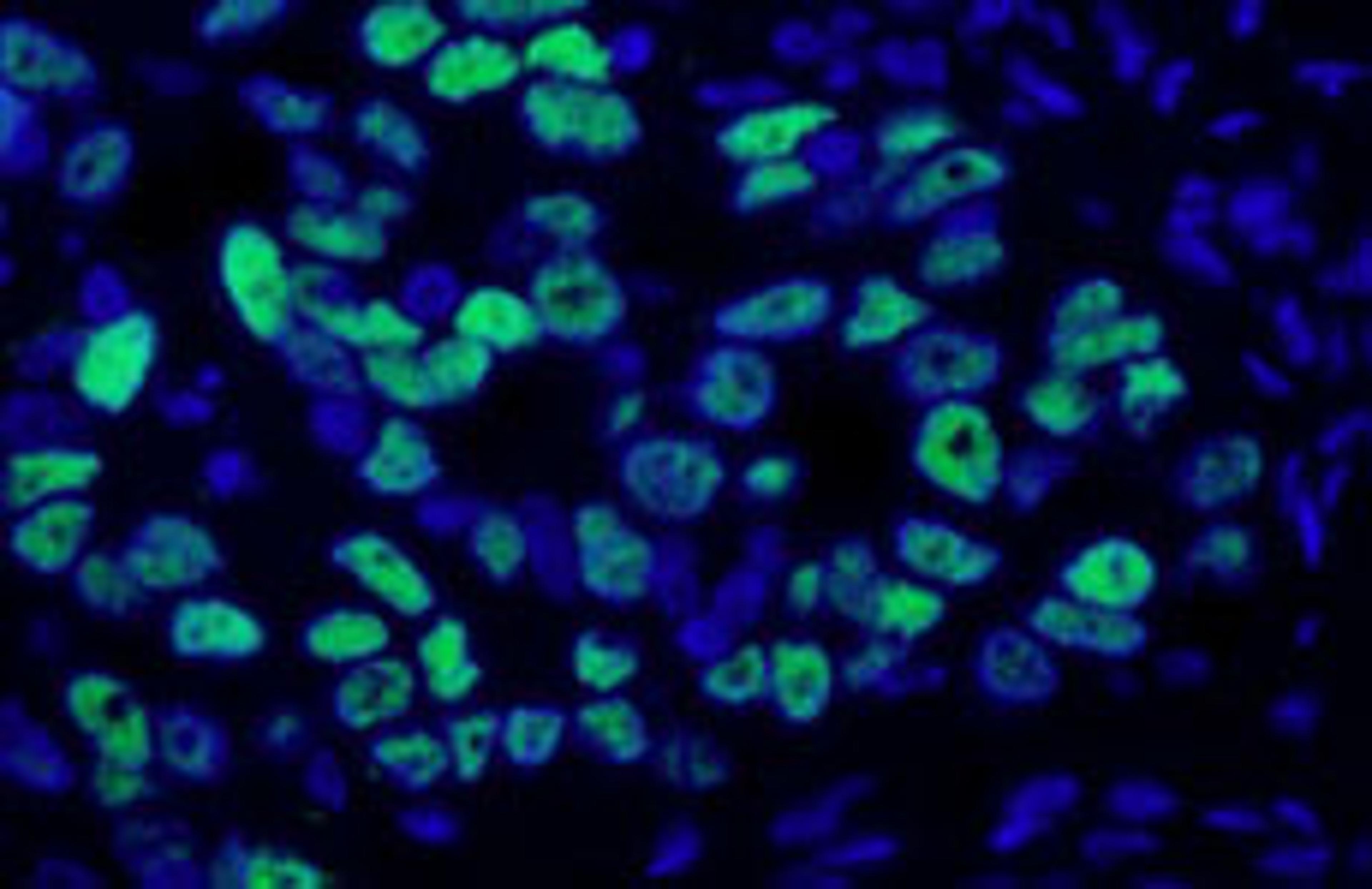 Detection of human p53 by immunofluorescence.