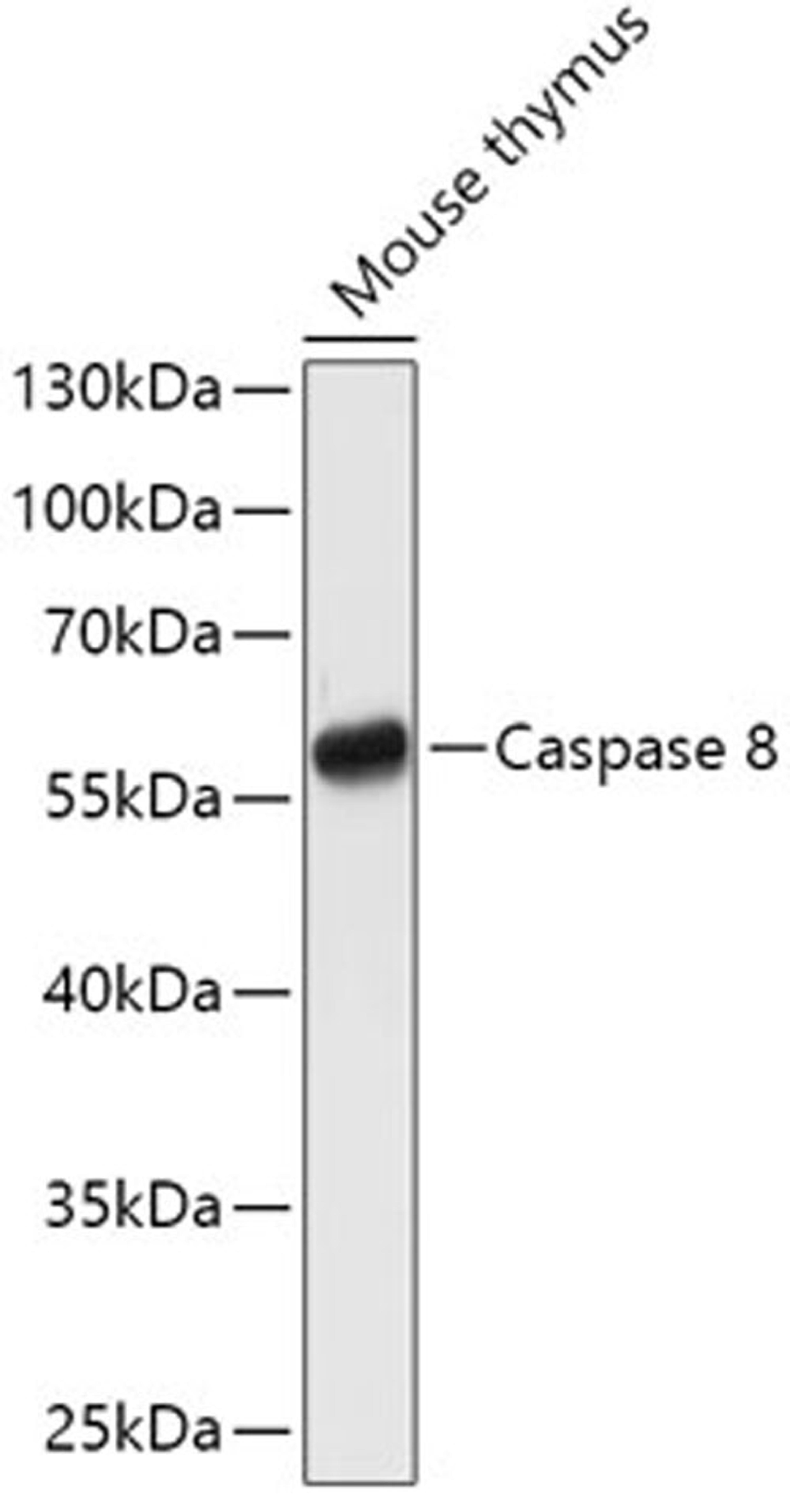 Western blot - Casp8 antibody (A11324)