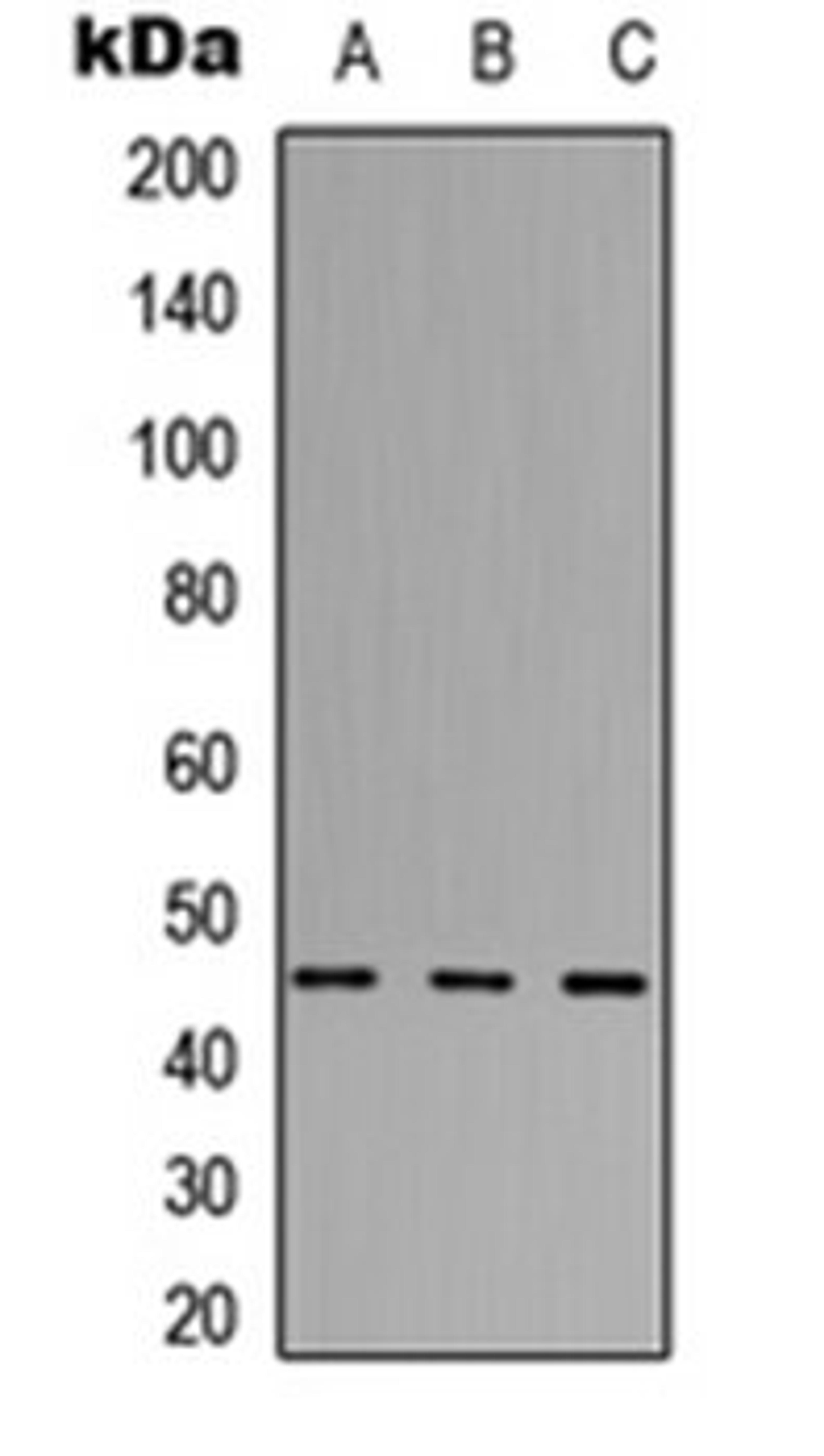 Western blot analysis of HEK293T (Lane 1), Raw264.7 (Lane 2), PC12 (Lane 3) whole cell lysates using ABHD3 antibody