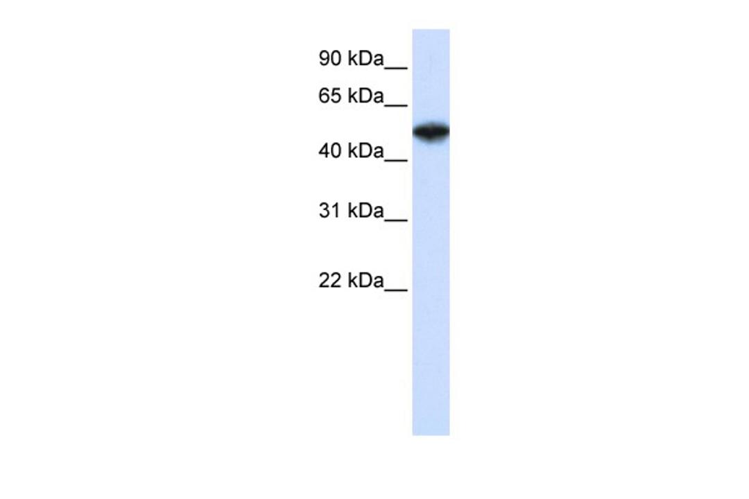 Antibody used in WB on Human Jurkat 0.5 ug/ml.