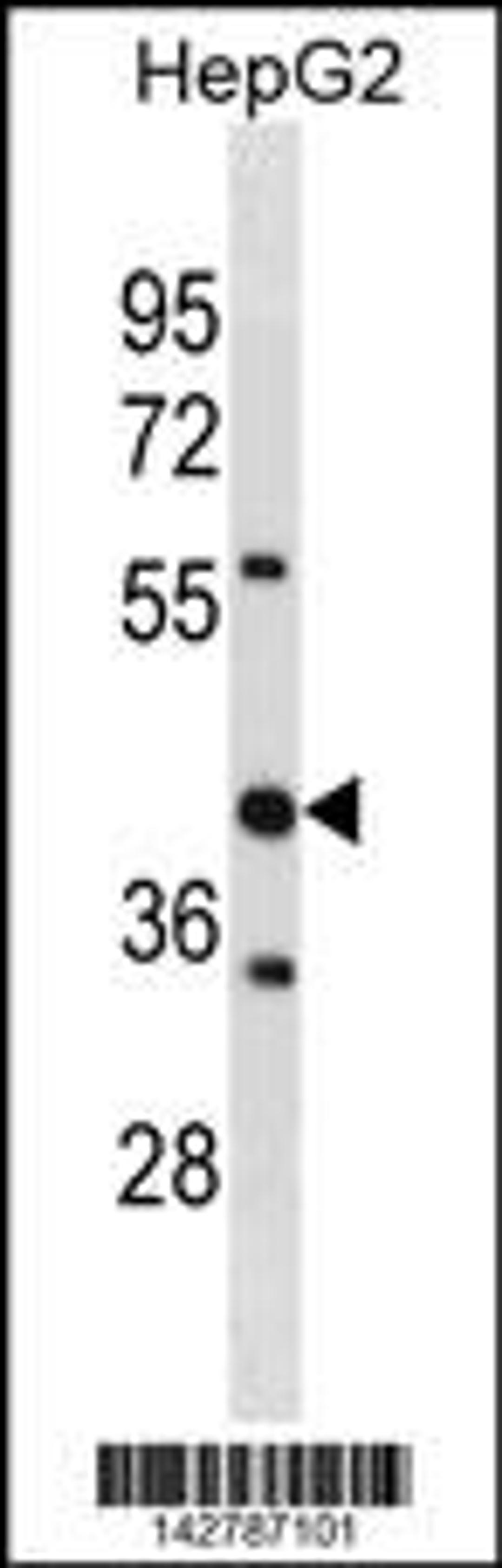 Western blot analysis in HepG2 cell line lysates (35ug/lane).