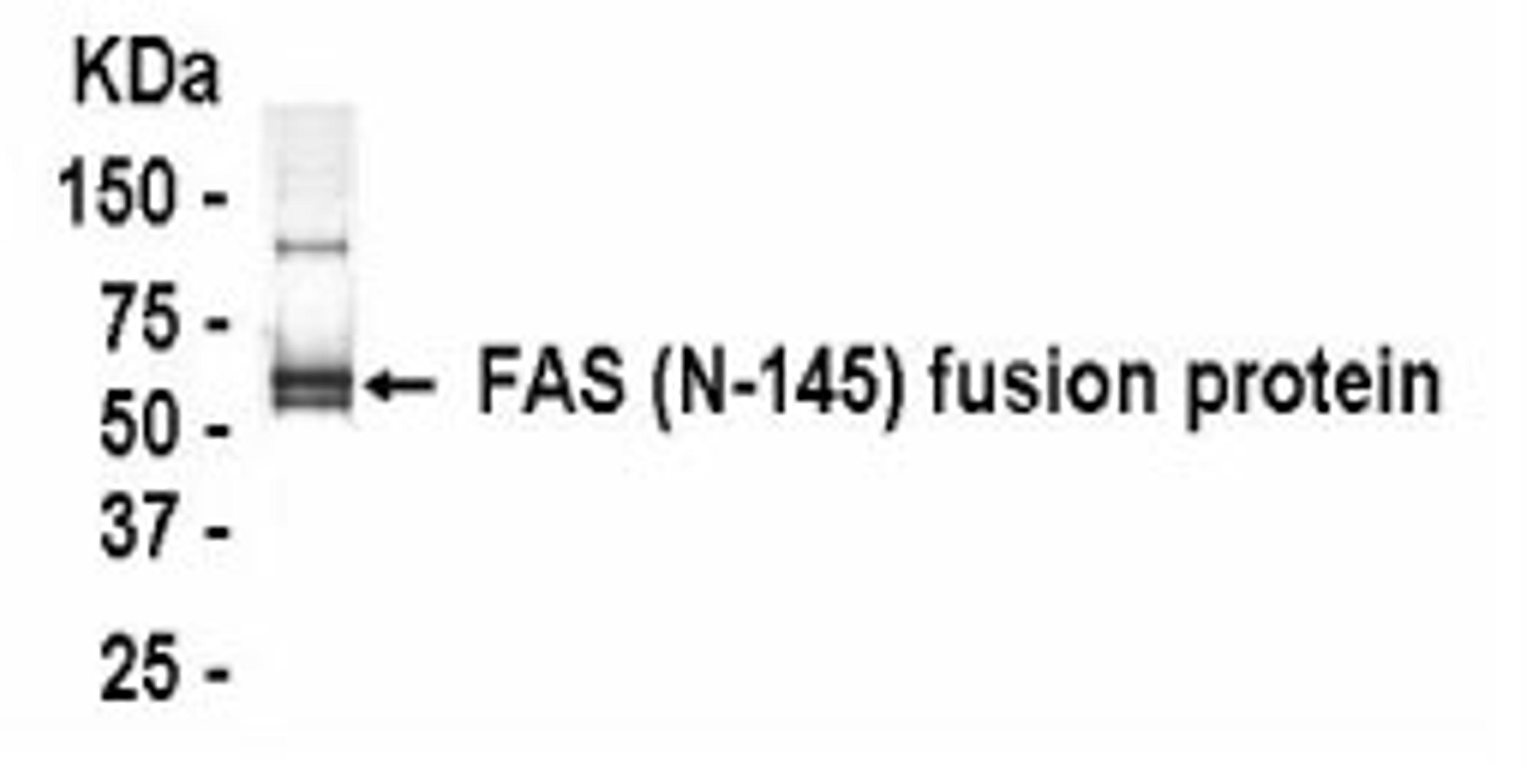 Western Blot: XW-7192 dilution: 1:2,000, Goat anti-HRP dilution: 1:1,000. E coli-derived fusion protein as test antigen.