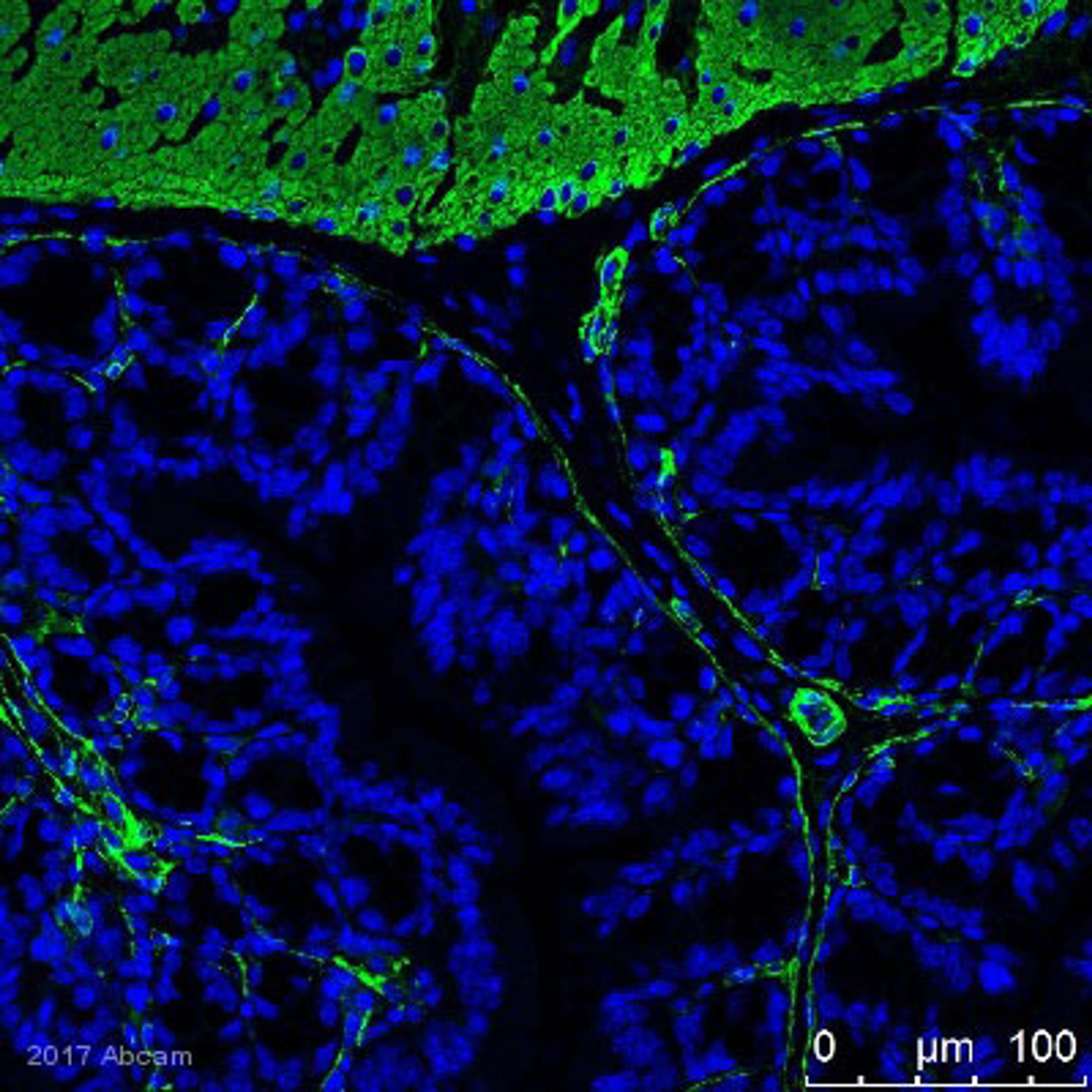 Immunohistochemistry (FFPE) - Anti-alpha smooth muscle Actin antibody [1A4]