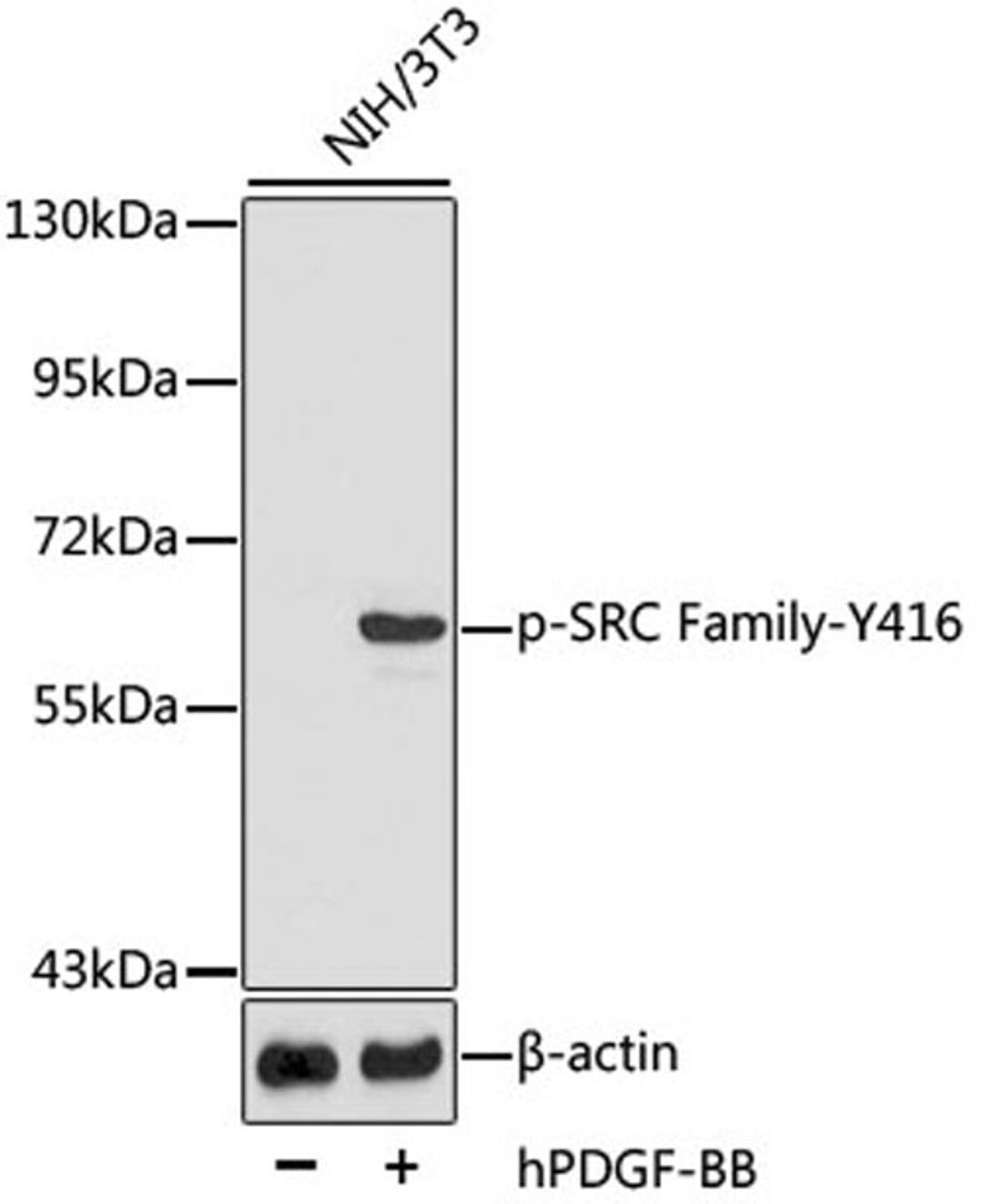 Western blot - Phospho-SRC Family-Y416 antibody (AP0511)