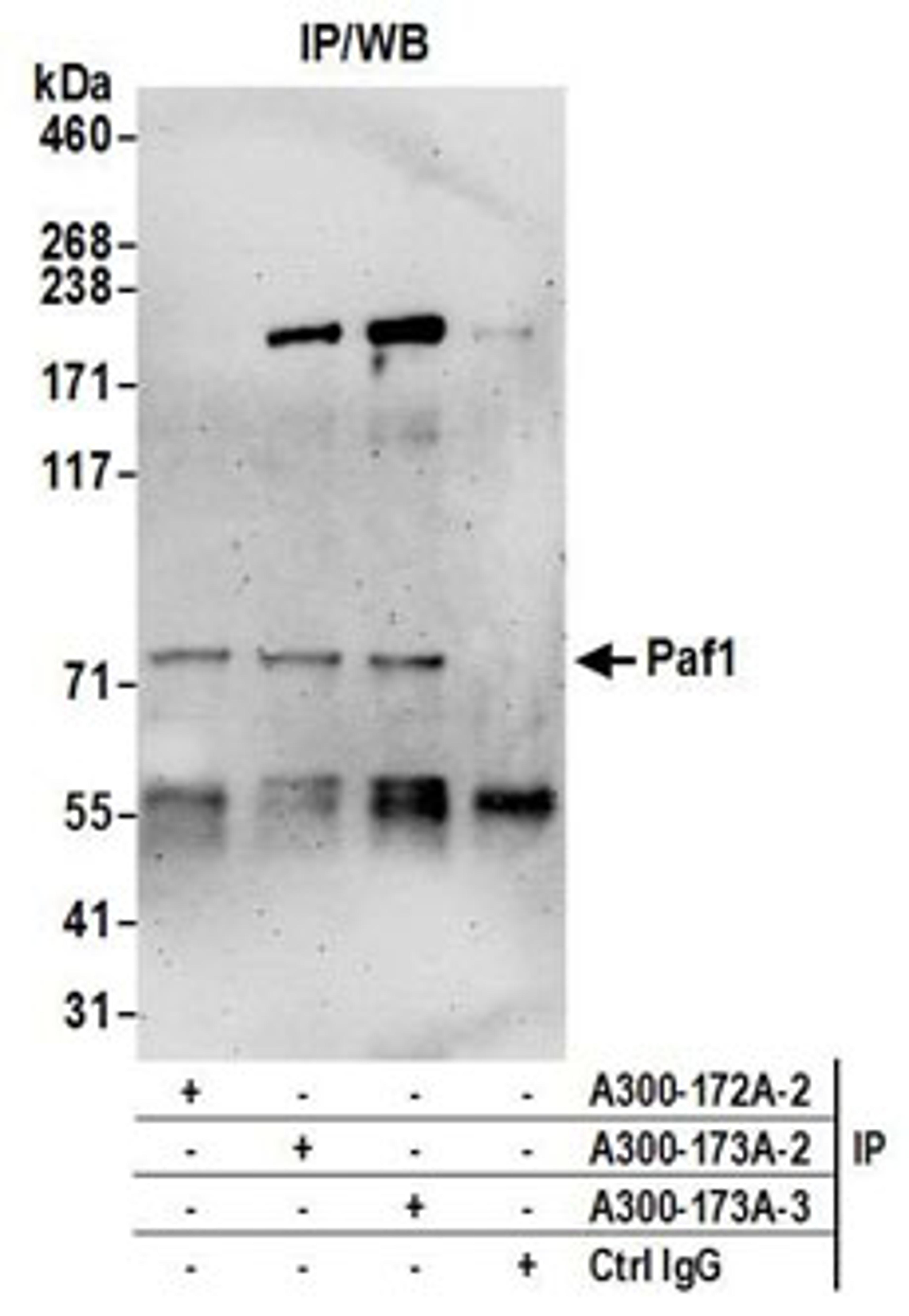 Detection of human Paf1 by western blot of immunoprecipitates.