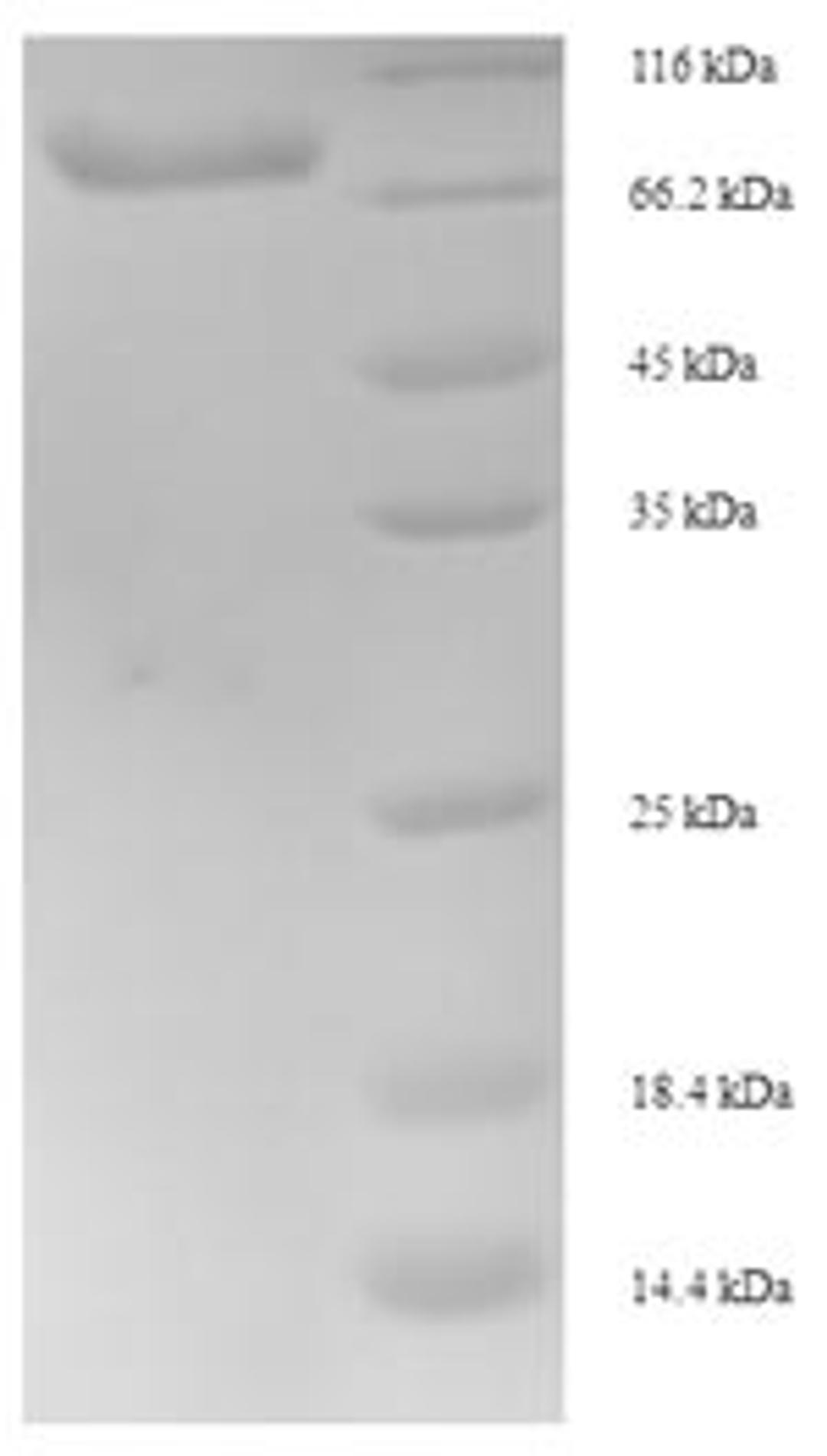 (Tris-Glycine gel) Discontinuous SDS-PAGE (reduced) with 5% enrichment gel and 15% separation gel.
