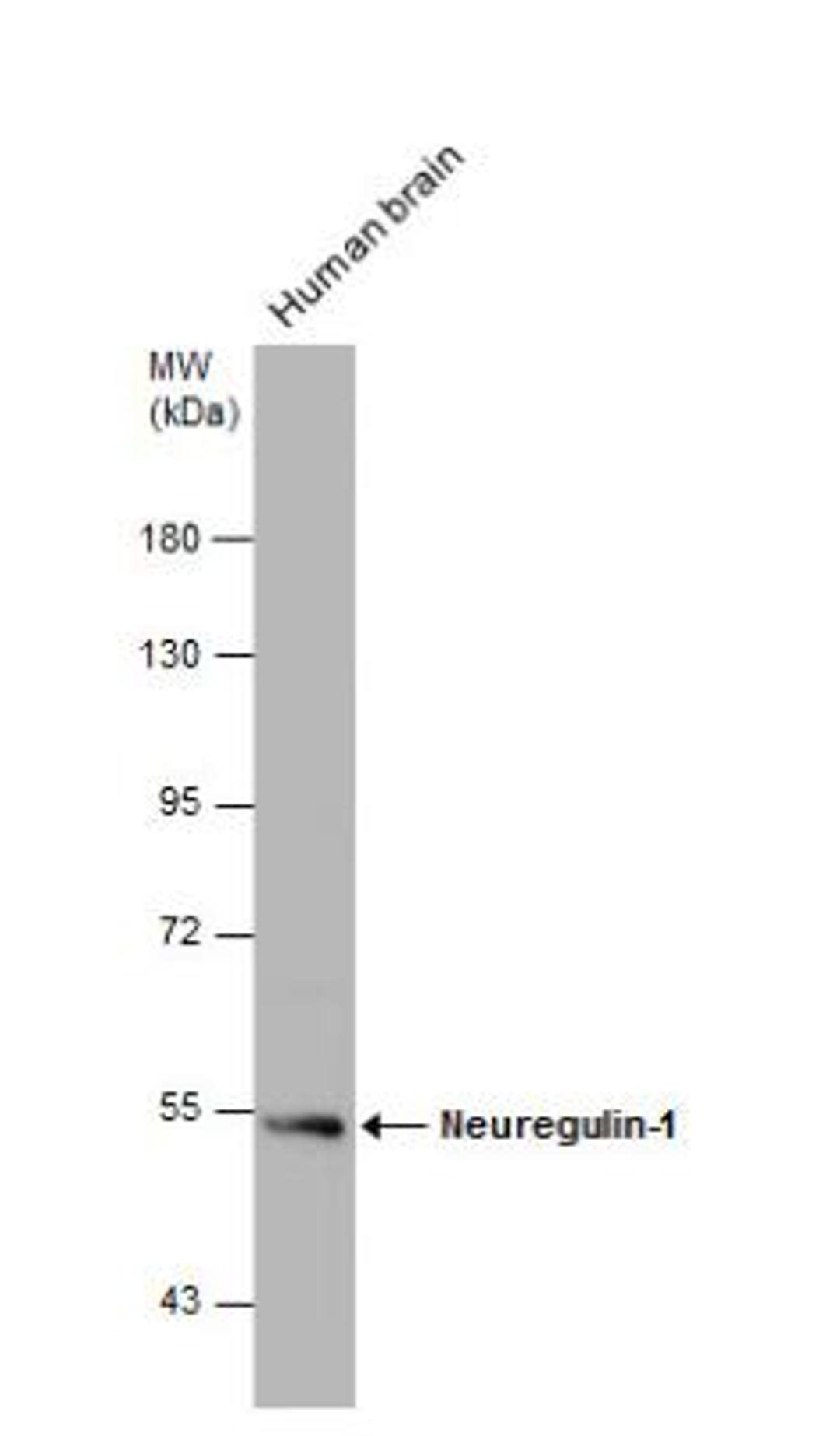 Western Blot: Neuregulin-1/NRG1 Antibody [NBP2-19587] - Human tissue extract (30 ug) was separated by 7.5% SDS-PAGE, and the membrane was blotted with Neuregulin-1 antibody  diluted at 1:1000.