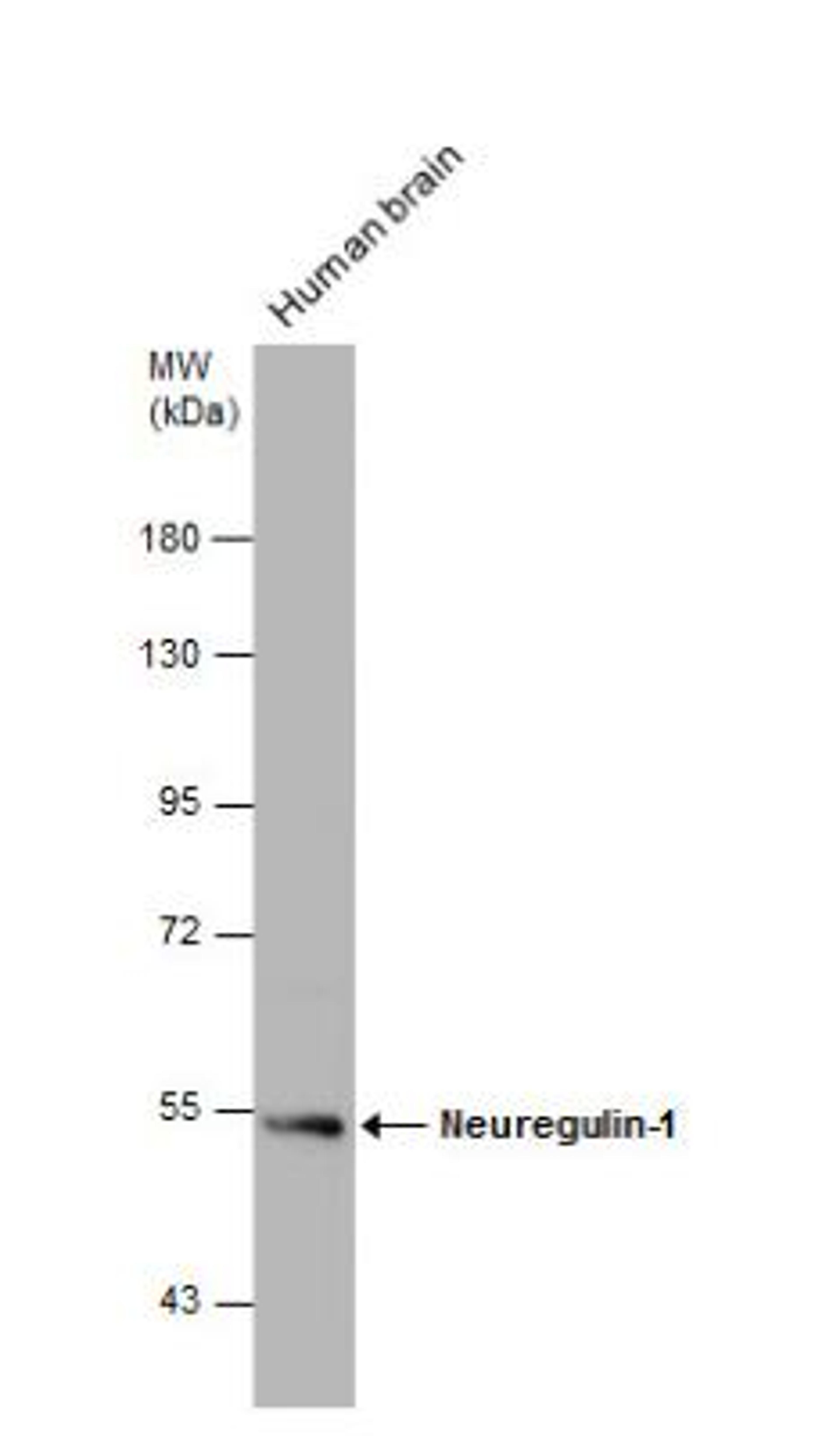 Western Blot: Neuregulin-1/NRG1 Antibody [NBP2-19587] - Human tissue extract (30 ug) was separated by 7.5% SDS-PAGE, and the membrane was blotted with Neuregulin-1 antibody  diluted at 1:1000.