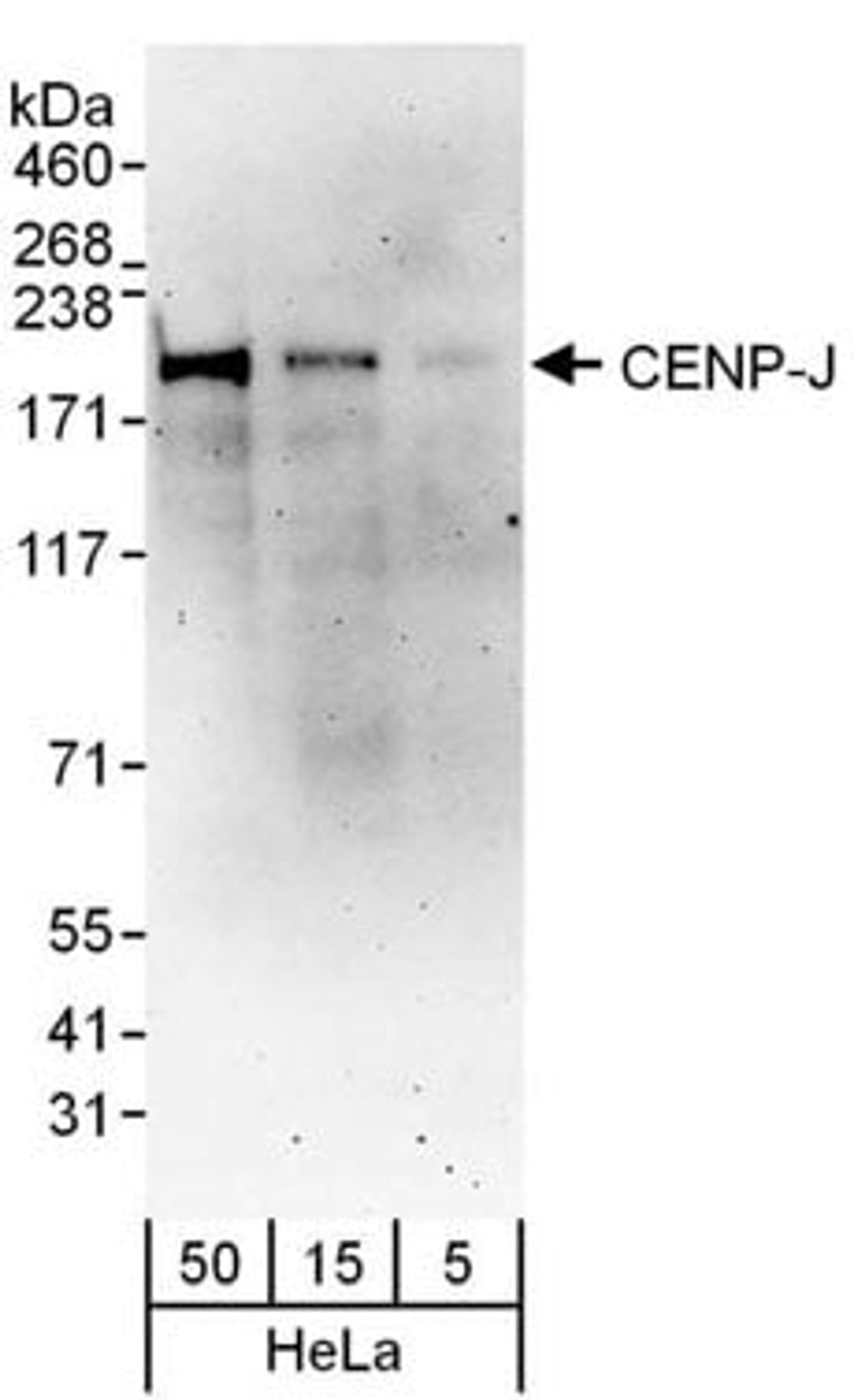 Detection of human CENP-J by western blot.