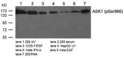 Western blot analysis of lysed extracts from various cells using ASK1 (Phospho-Ser966).