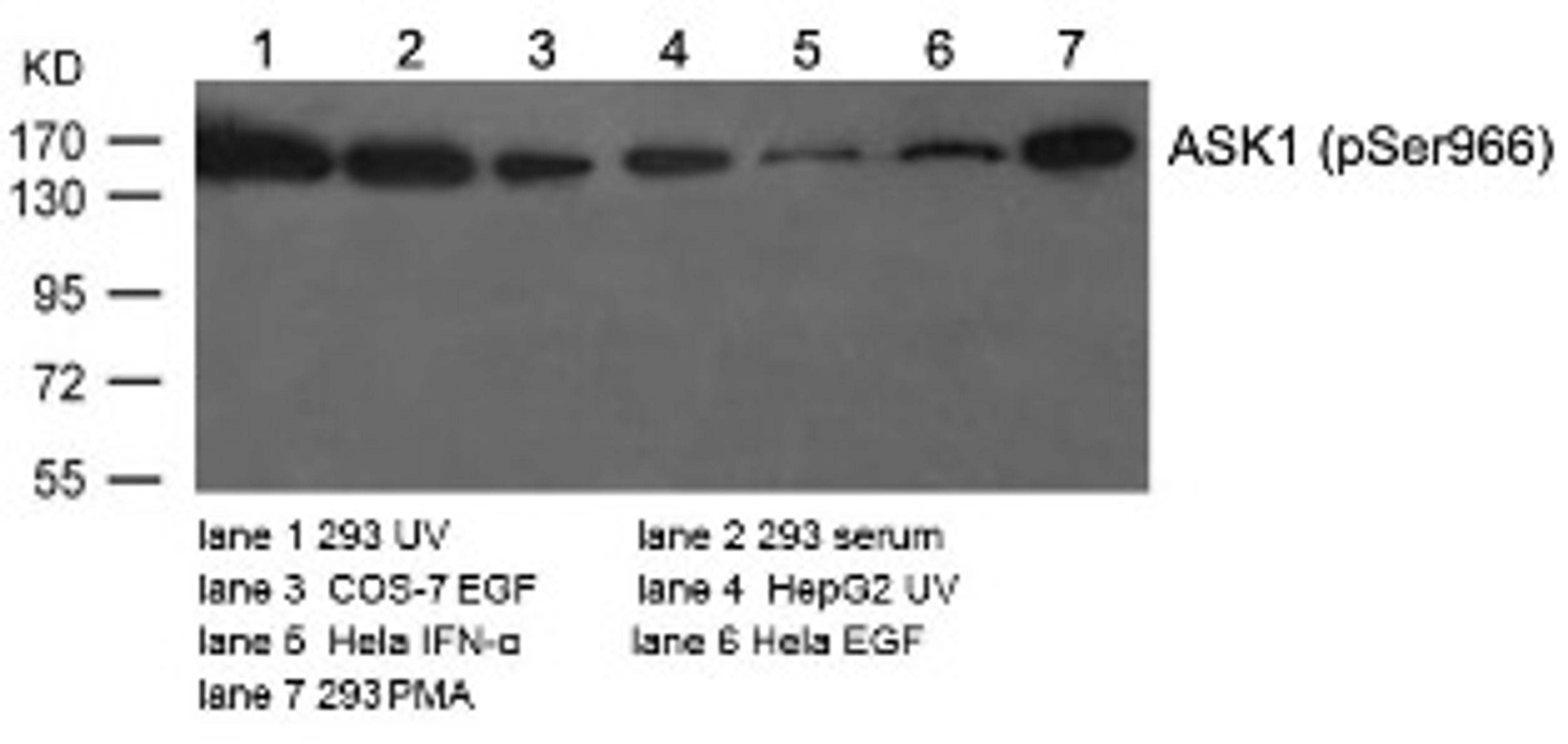 Western blot analysis of lysed extracts from various cells using ASK1 (Phospho-Ser966).