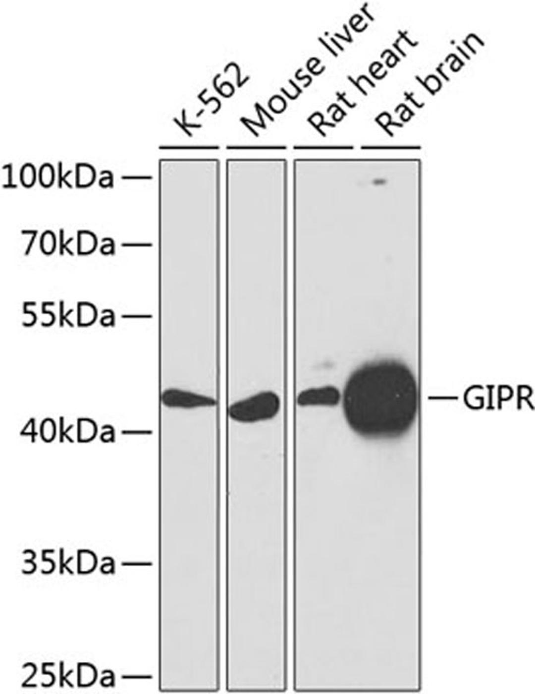 Western blot - GIPR antibody (A9816)