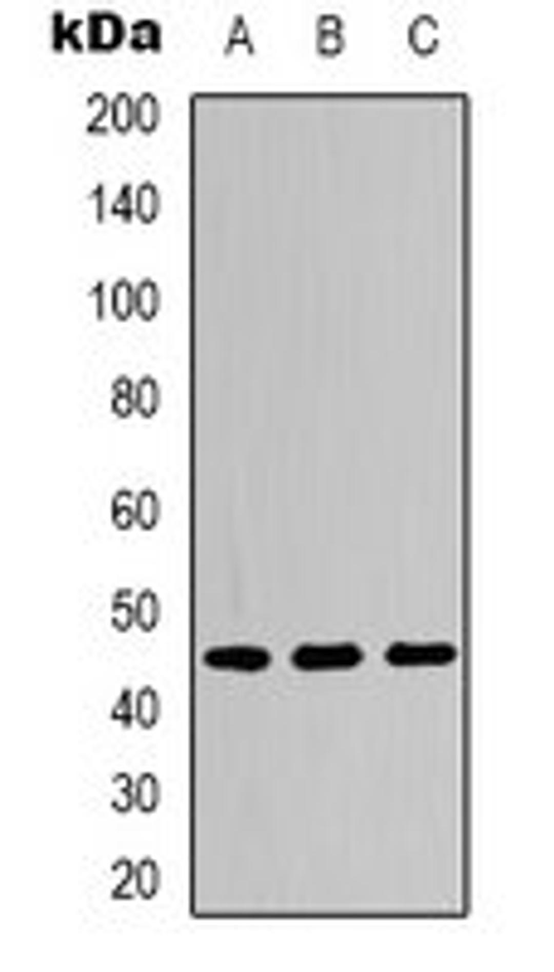 Western blot analysis of Hela LPS-treated (Lane 1), NIH3T3 LPS-treated (Lane 2), PC12 H2O2-treated (Lane 3) whole cell lysates using IKB epsilon (phospho-S22) antibody