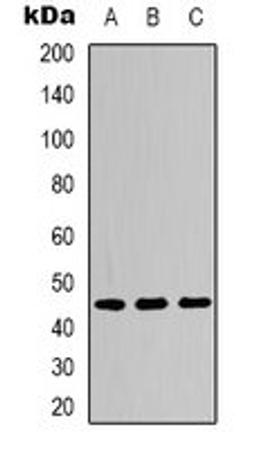 Western blot analysis of Hela LPS-treated (Lane 1), NIH3T3 LPS-treated (Lane 2), PC12 H2O2-treated (Lane 3) whole cell lysates using IKB epsilon (phospho-S22) antibody