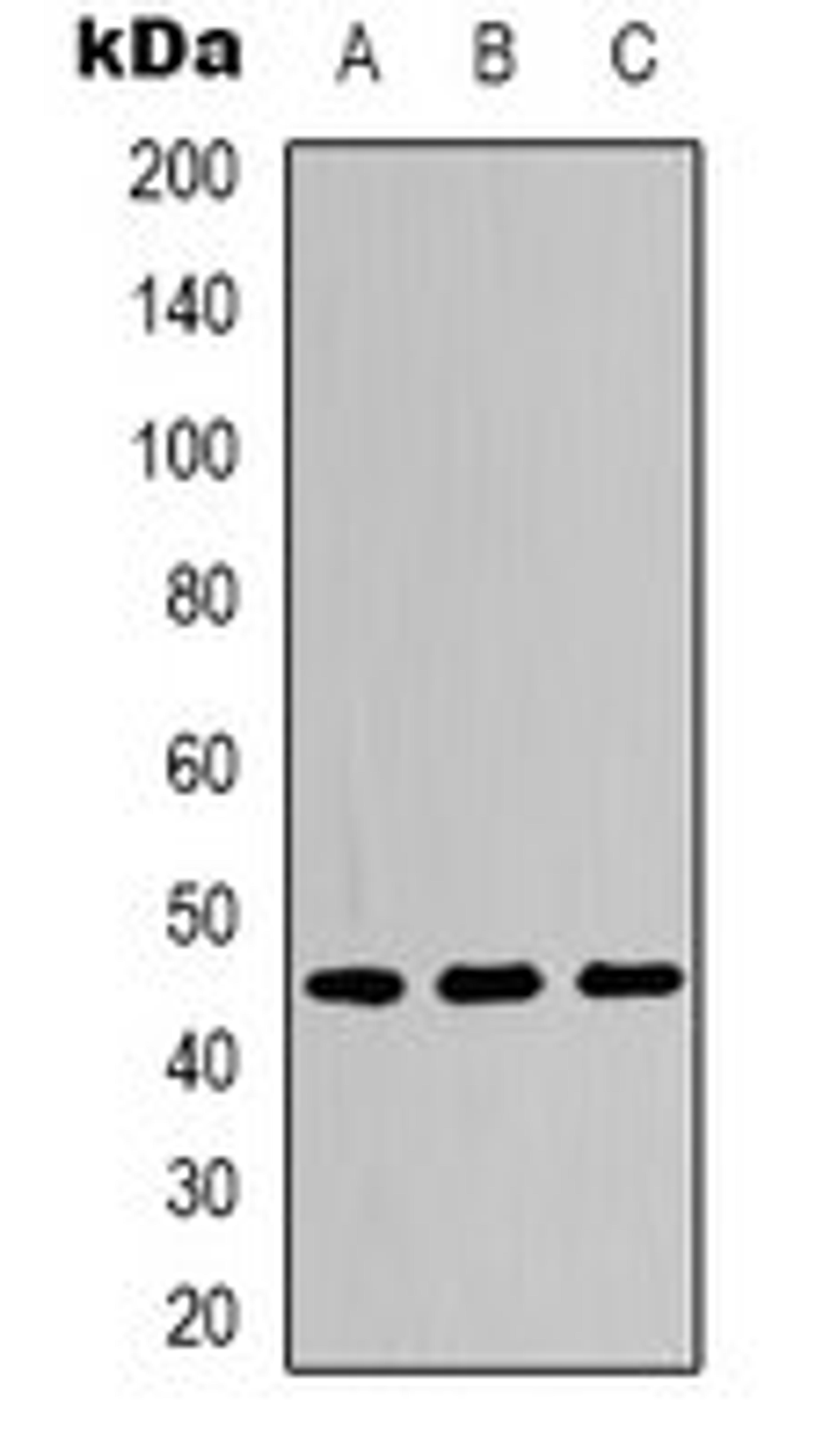 Western blot analysis of Hela LPS-treated (Lane 1), NIH3T3 LPS-treated (Lane 2), PC12 H2O2-treated (Lane 3) whole cell lysates using IKB epsilon (phospho-S22) antibody