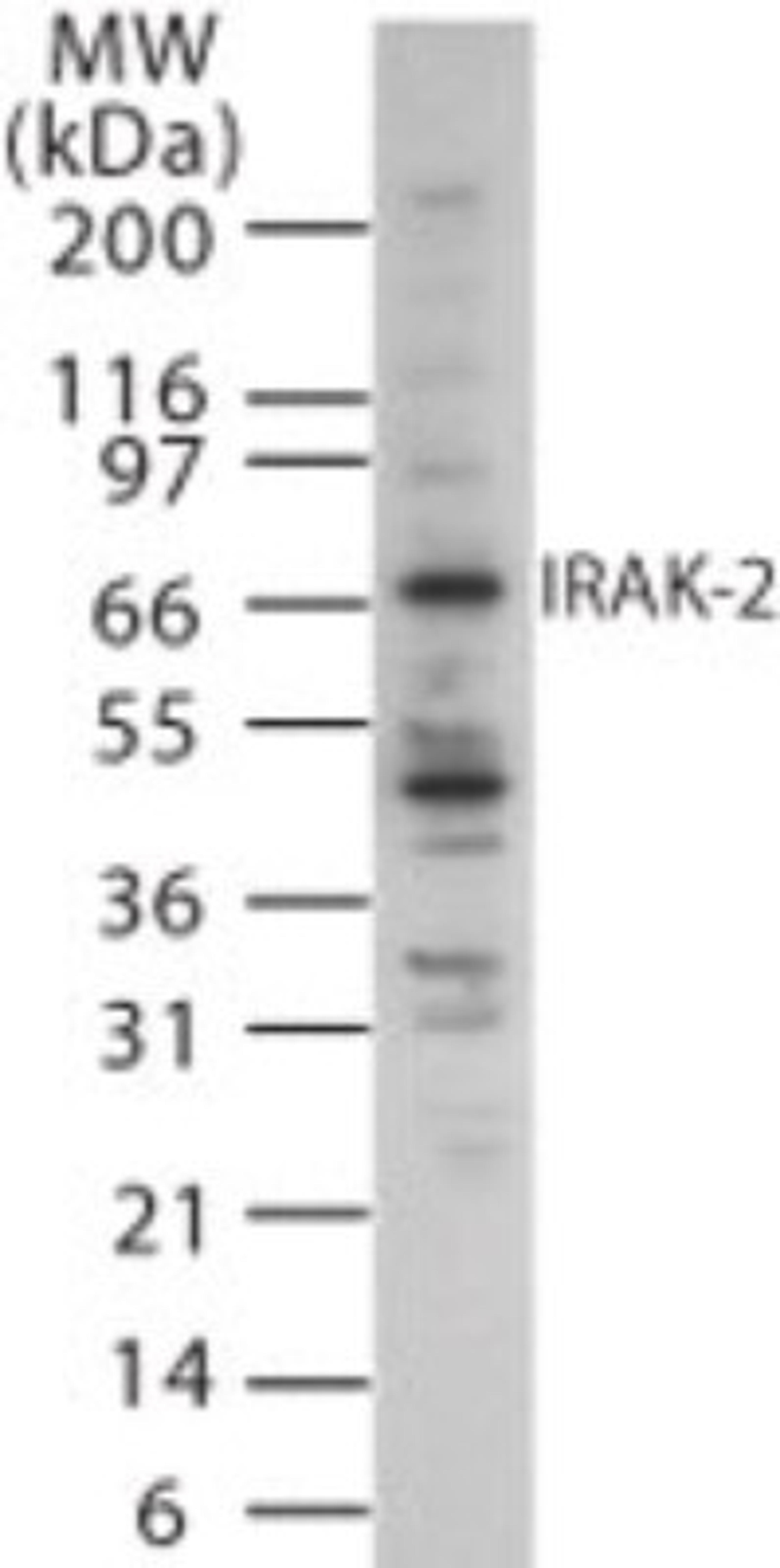 Western Blot: IRAK2 Antibody [NB100-56447] - Western blot analysis of IRAK-2 in 15 ugs of Jurkat cell lysate using NB100-56447 at 1 ug/ml.