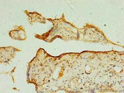 Immunohistochemistry of paraffin-embedded human placenta tissue using CSB-PA622522LA01HU at dilution of 1:100