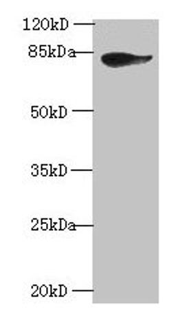 Western blot. All lanes: JUP antibody at 2µg/ml + A431 whole cell lysate. Secondary. Goat polyclonal to rabbit IgG at 1/10000 dilution. Predicted band size: 82 kDa. Observed band size: 82 kDa
