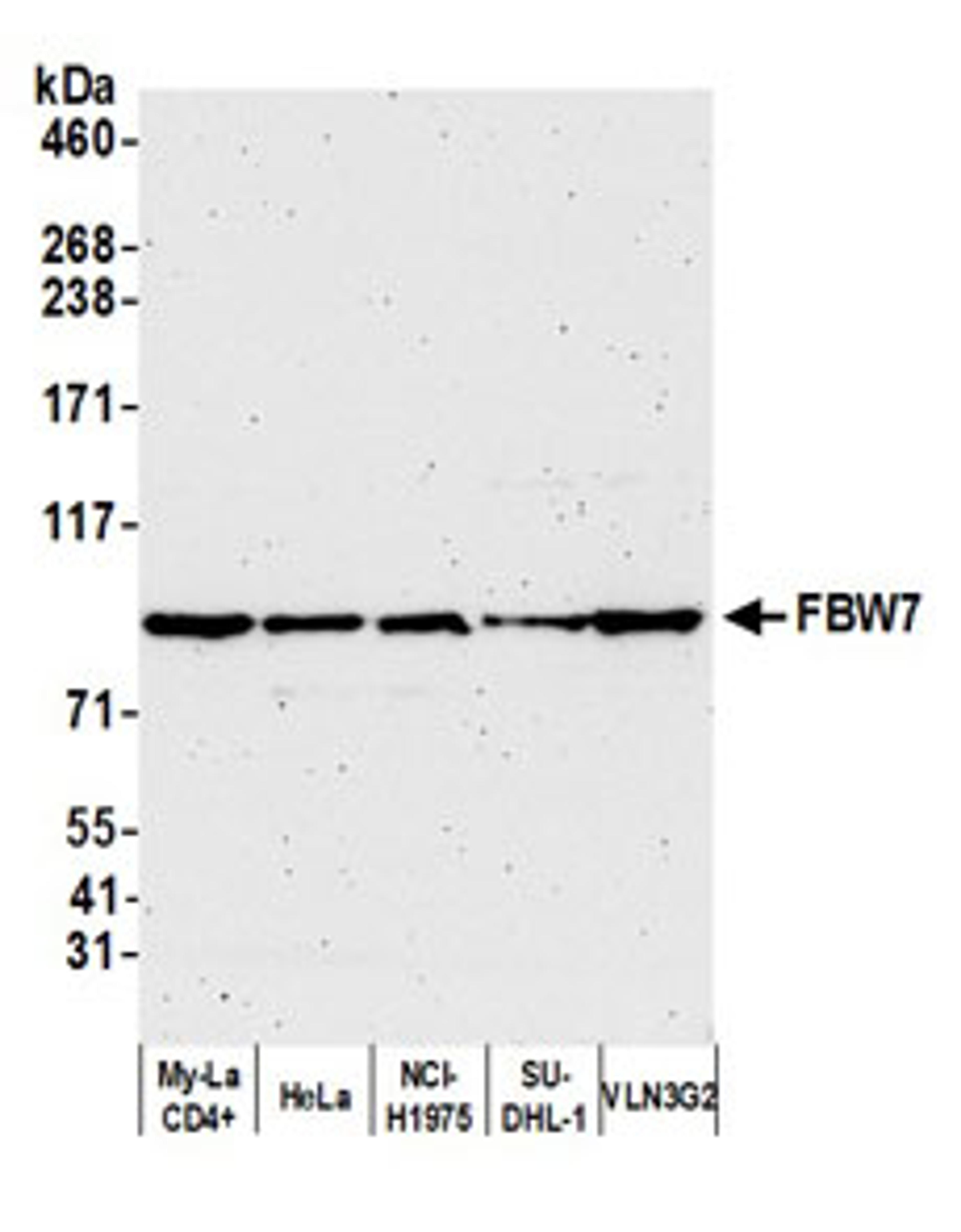 Detection of human FBW7 by western blot.