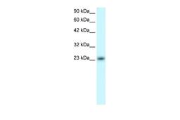 Antibody used in WB on Human Jurkat 0.2-1 ug/ml.