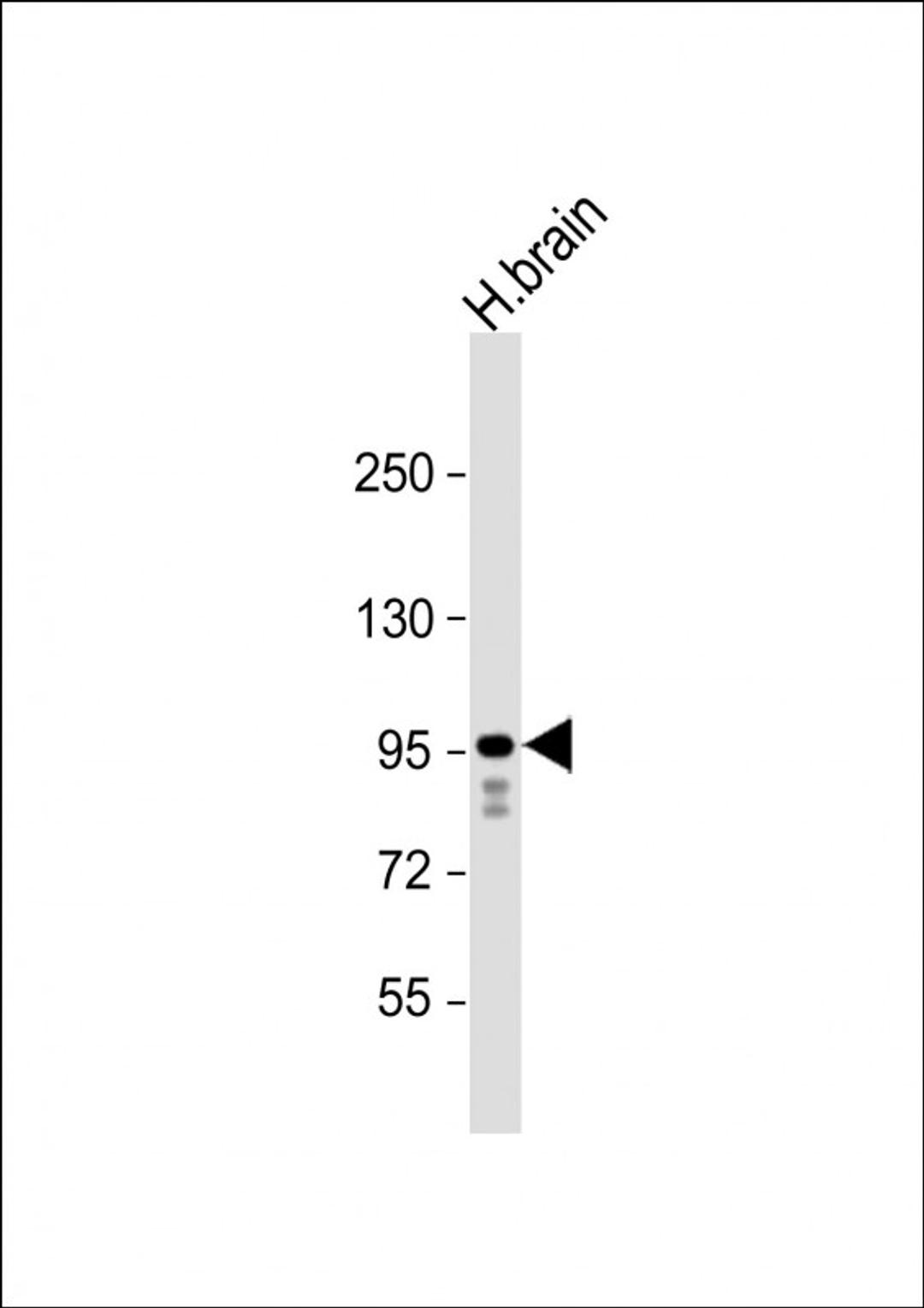 Western Blot at 1:1000 dilution + human brain lysate Lysates/proteins at 20 ug per lane.