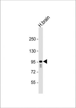 Western Blot at 1:1000 dilution + human brain lysate Lysates/proteins at 20 ug per lane.