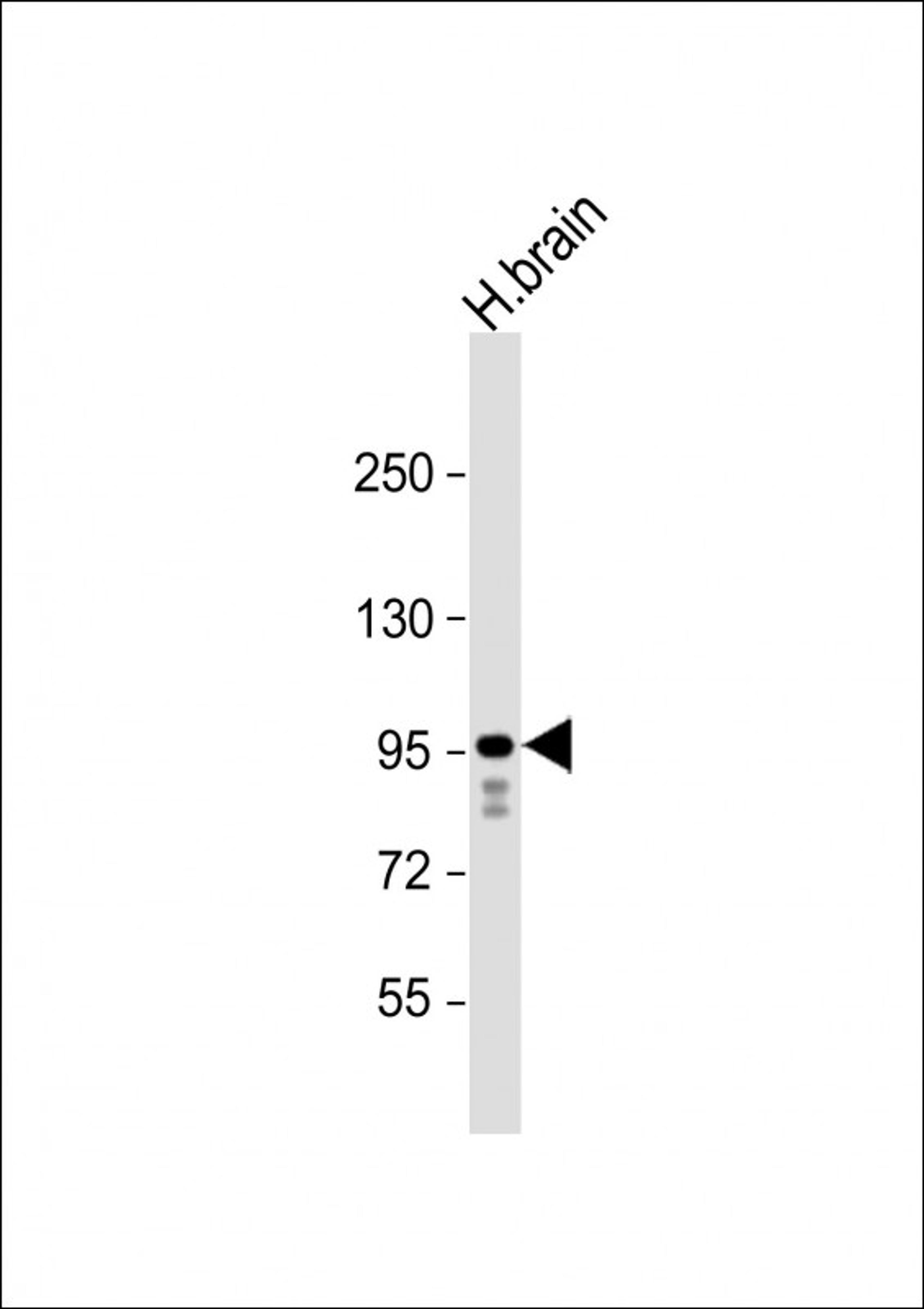 Western Blot at 1:1000 dilution + human brain lysate Lysates/proteins at 20 ug per lane.