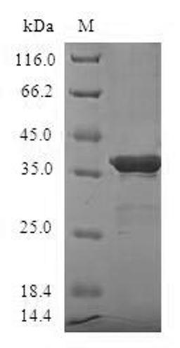 (Tris-Glycine gel) Discontinuous SDS-PAGE (reduced) with 5% enrichment gel and 15% separation gel.