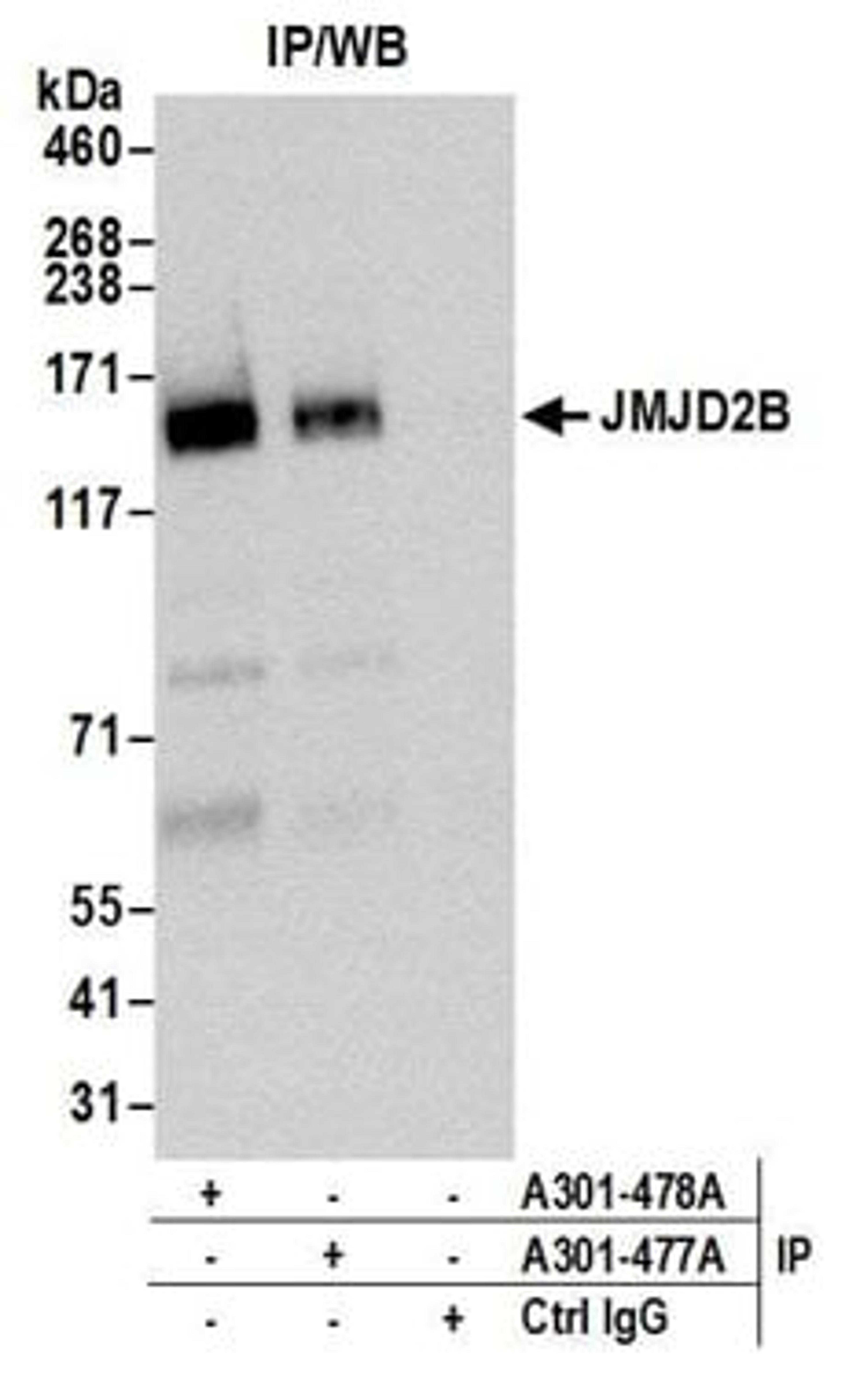 Detection of human JMJD2B by western blot of immunoprecipitates.