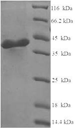 (Tris-Glycine gel) Discontinuous SDS-PAGE (reduced) with 5% enrichment gel and 15% separation gel.