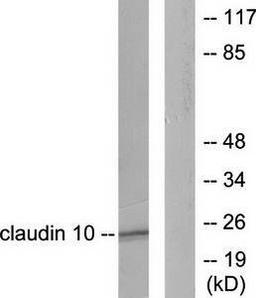 Western blot analysis of extracts from LOVO cells using Claudin 10 antibody