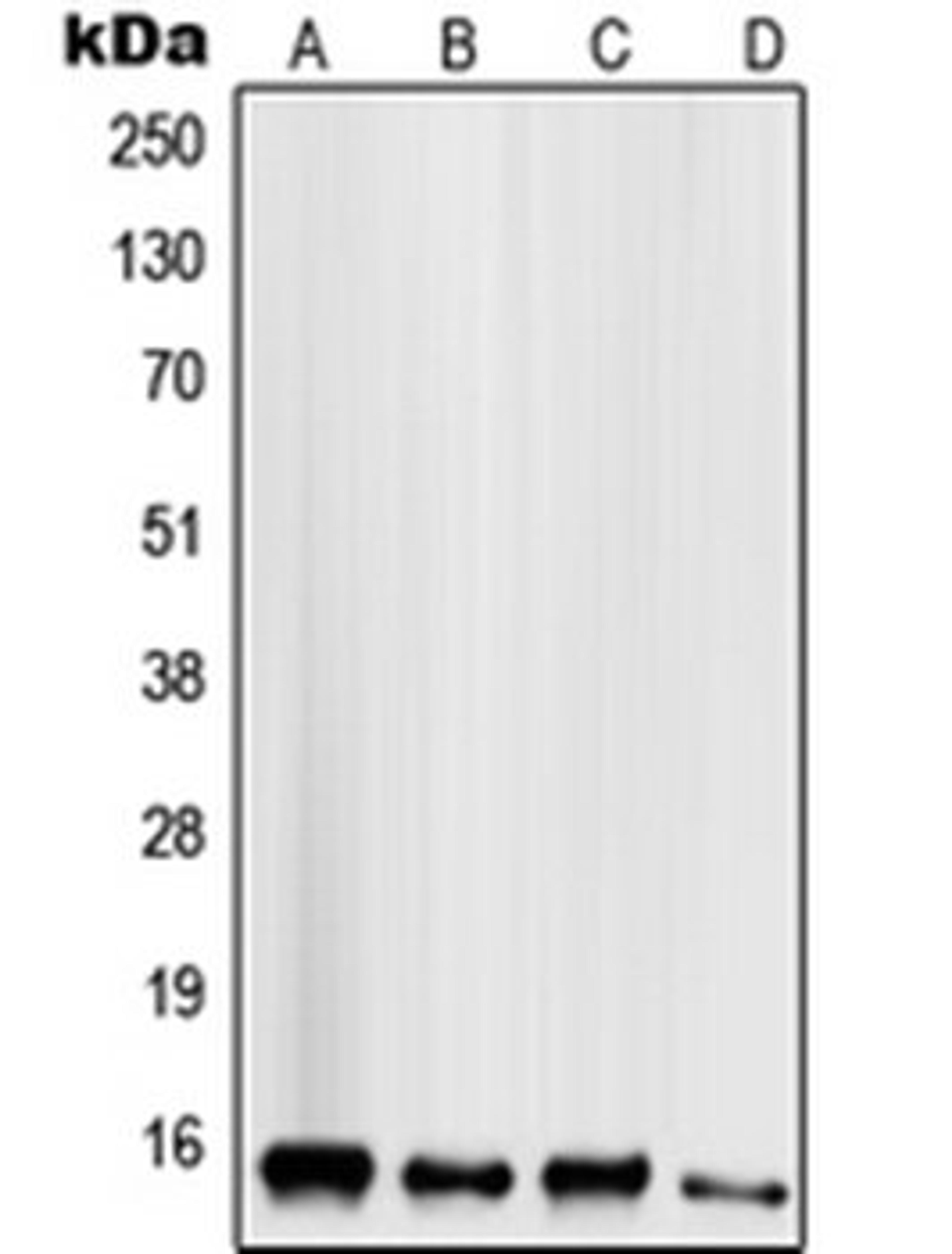 Western blot analysis of HeLa (Lane 1), HepG2 (Lane 2), MCF7 (Lane 3), MDAMB435 (Lane 4) whole cell lysates using SCGB2A1 antibody