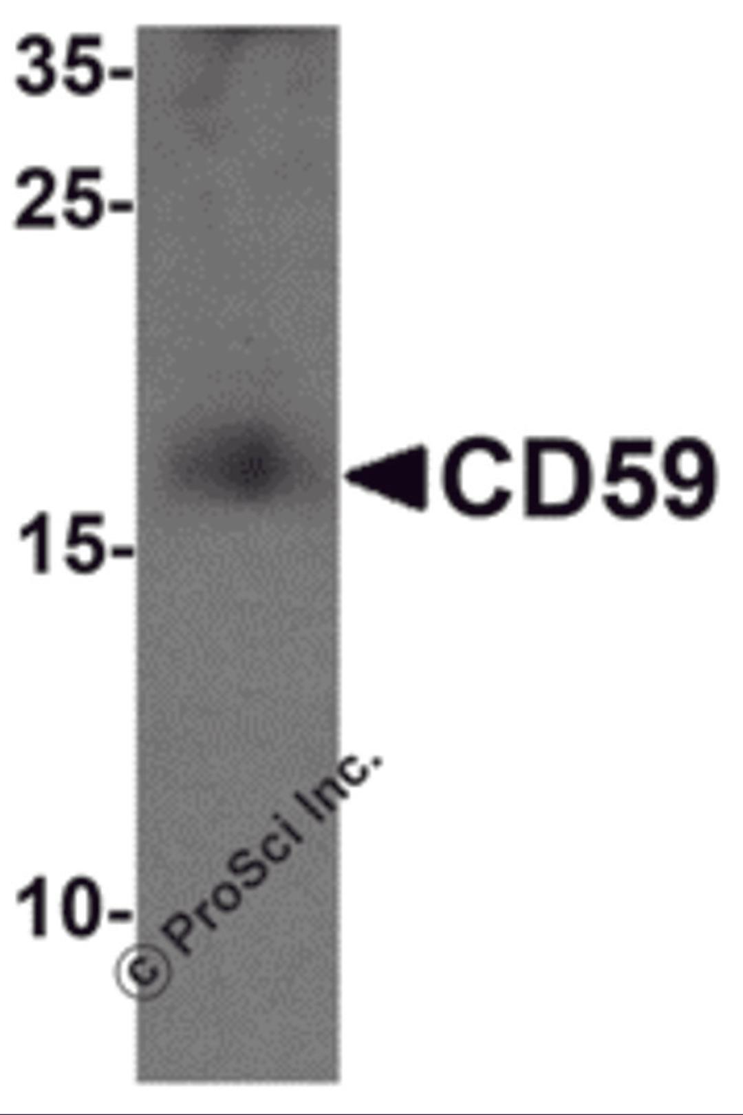 Western blot analysis of CD59 in mouse spleen tissue lysate with CD59 antibody at 1 μg/mL