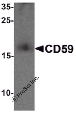 Western blot analysis of CD59 in mouse spleen tissue lysate with CD59 antibody at 1 μg/mL