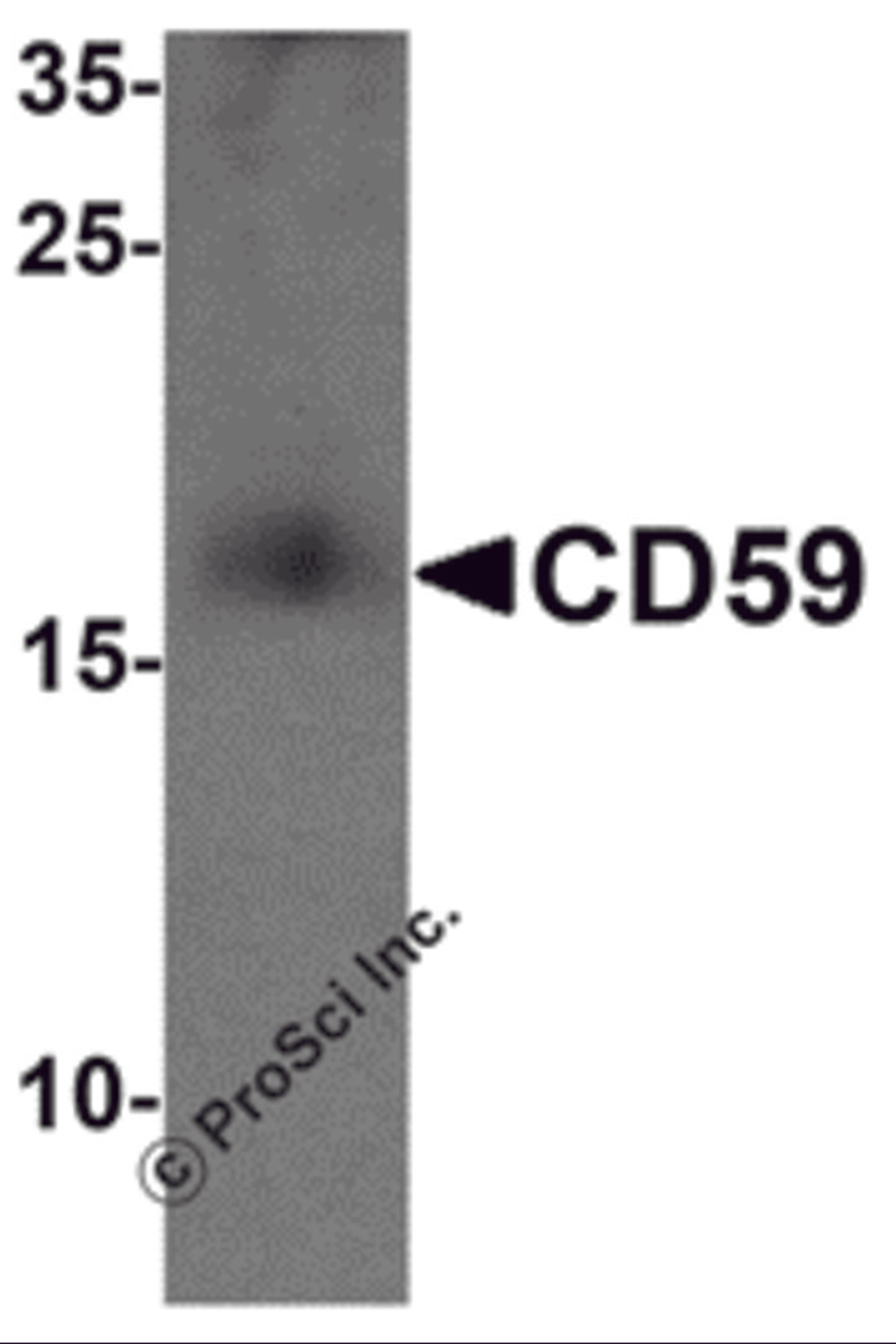 Western blot analysis of CD59 in mouse spleen tissue lysate with CD59 antibody at 1 μg/mL