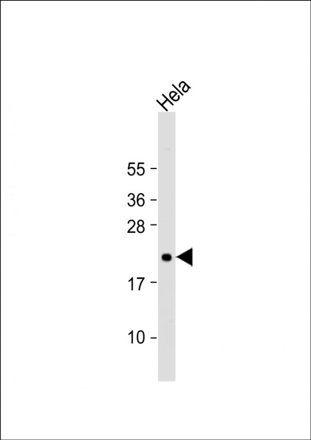 Western Blot at 1:2000 dilution + Hela whole cell lysate Lysates/proteins at 20 ug per lane.