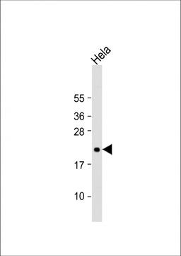 Western Blot at 1:2000 dilution + Hela whole cell lysate Lysates/proteins at 20 ug per lane.