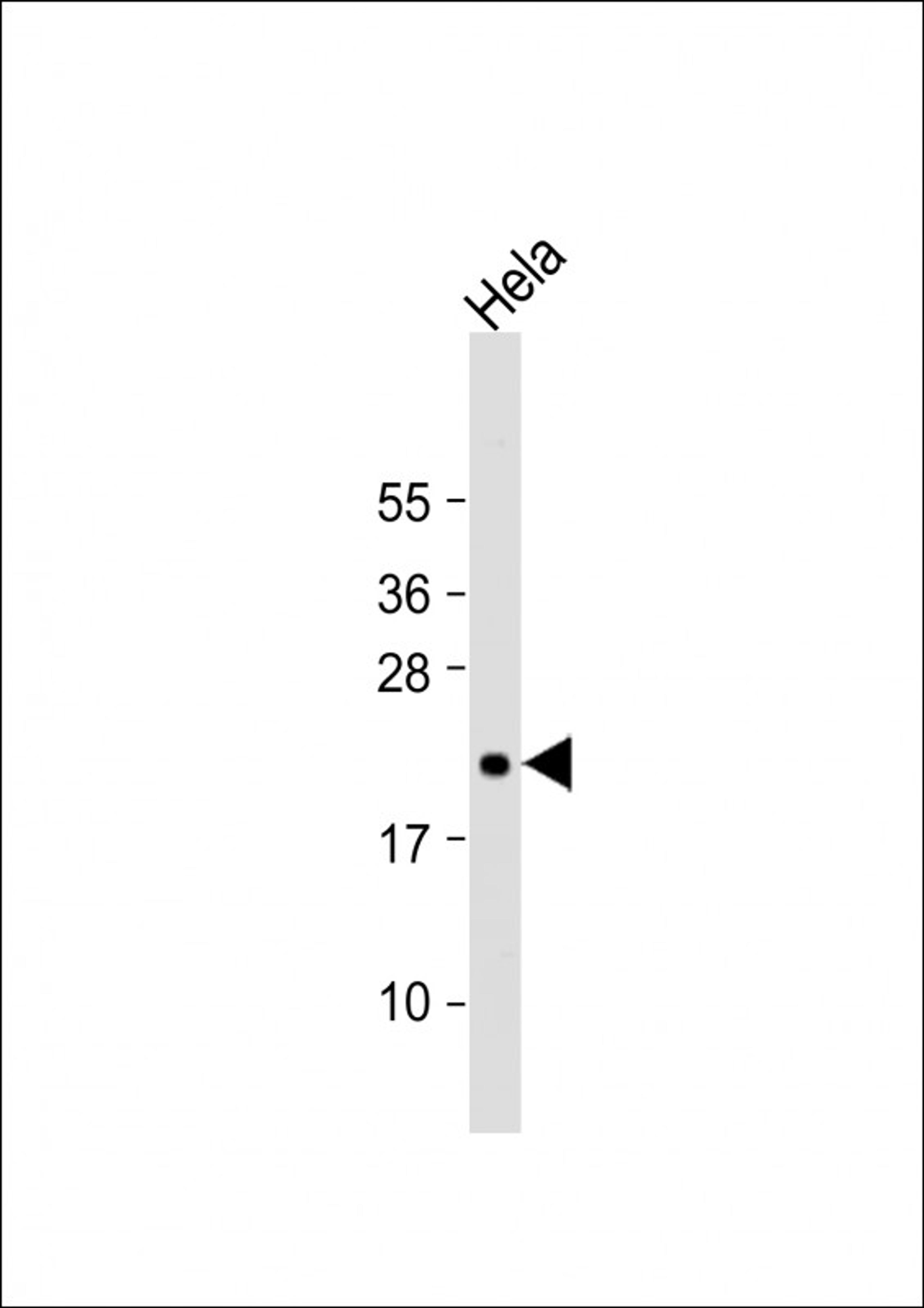 Western Blot at 1:2000 dilution + Hela whole cell lysate Lysates/proteins at 20 ug per lane.