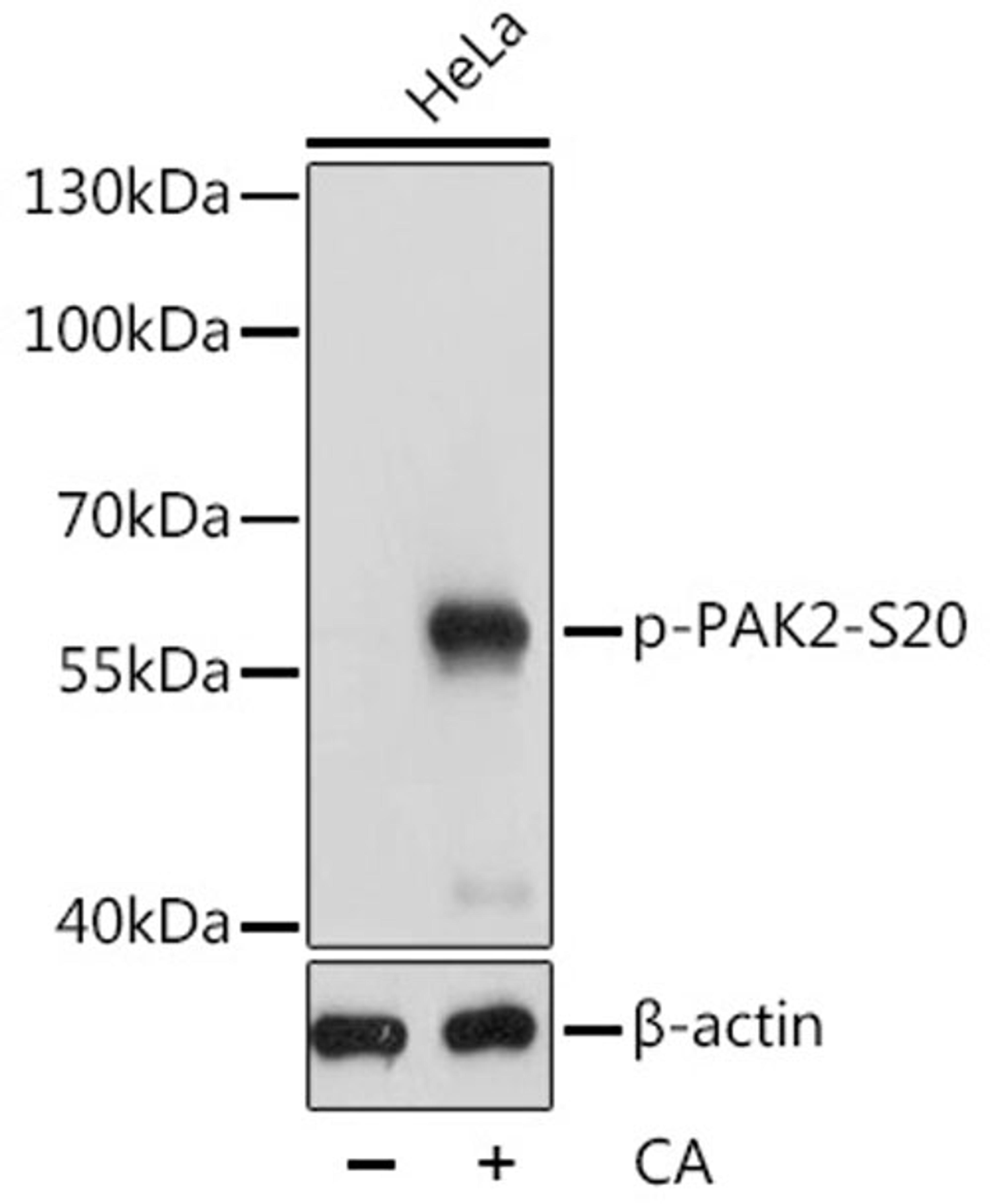 Western blot - Phospho-PAK2-S20 antibody (AP0803)