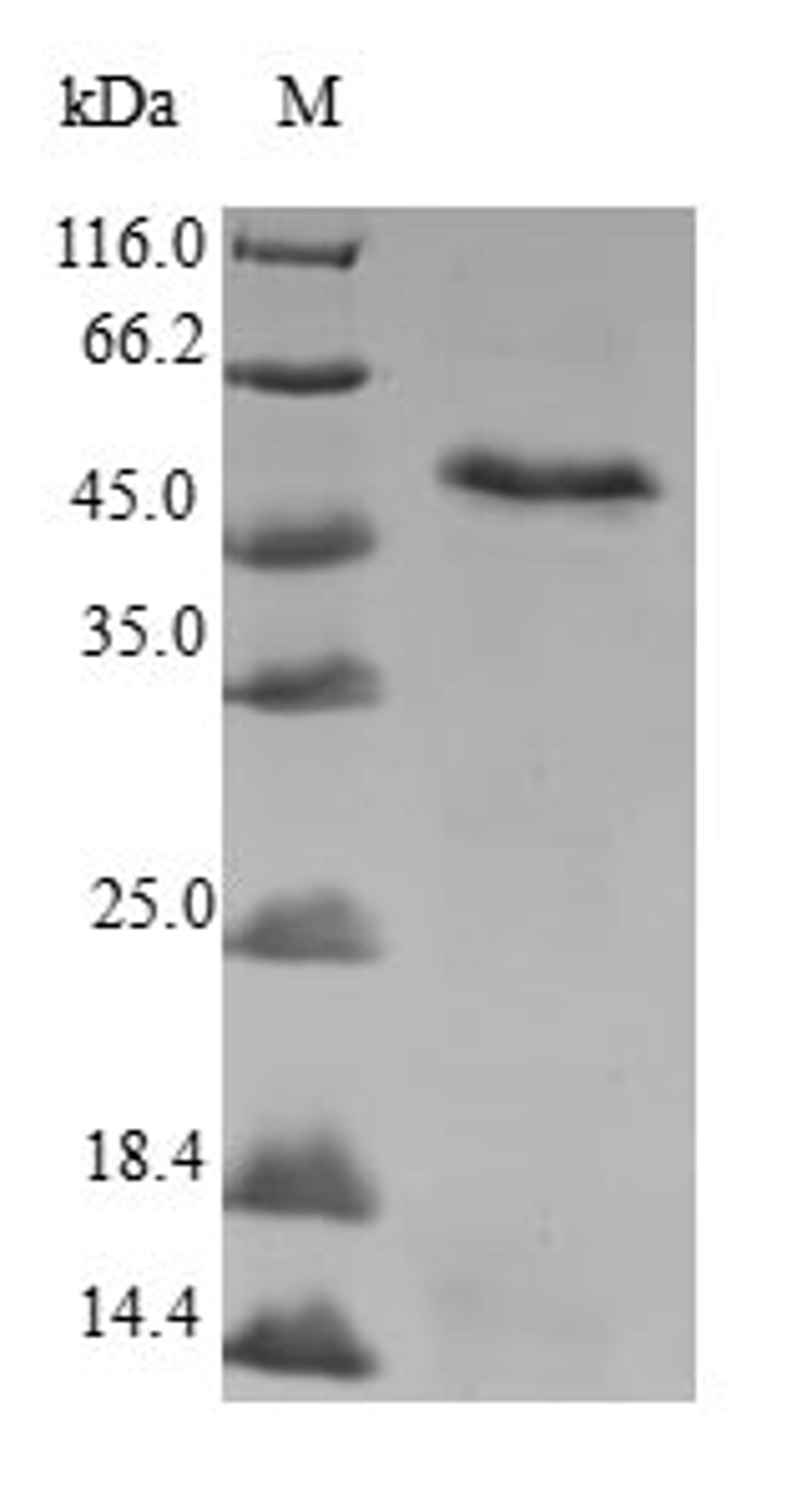 (Tris-Glycine gel) Discontinuous SDS-PAGE (reduced) with 5% enrichment gel and 15% separation gel.