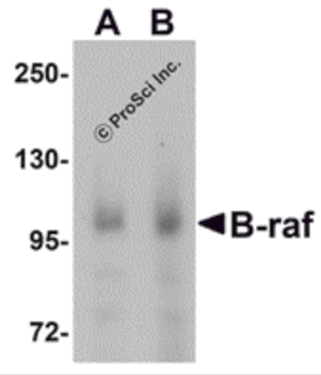 Western blot analysis of B-raf in human brain tissue lysate with B-raf antibody at (A) 1 and (B) 2 &#956;g/mL.