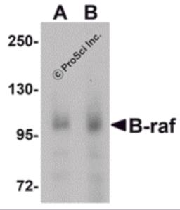 Western blot analysis of B-raf in human brain tissue lysate with B-raf antibody at (A) 1 and (B) 2 &#956;g/mL.