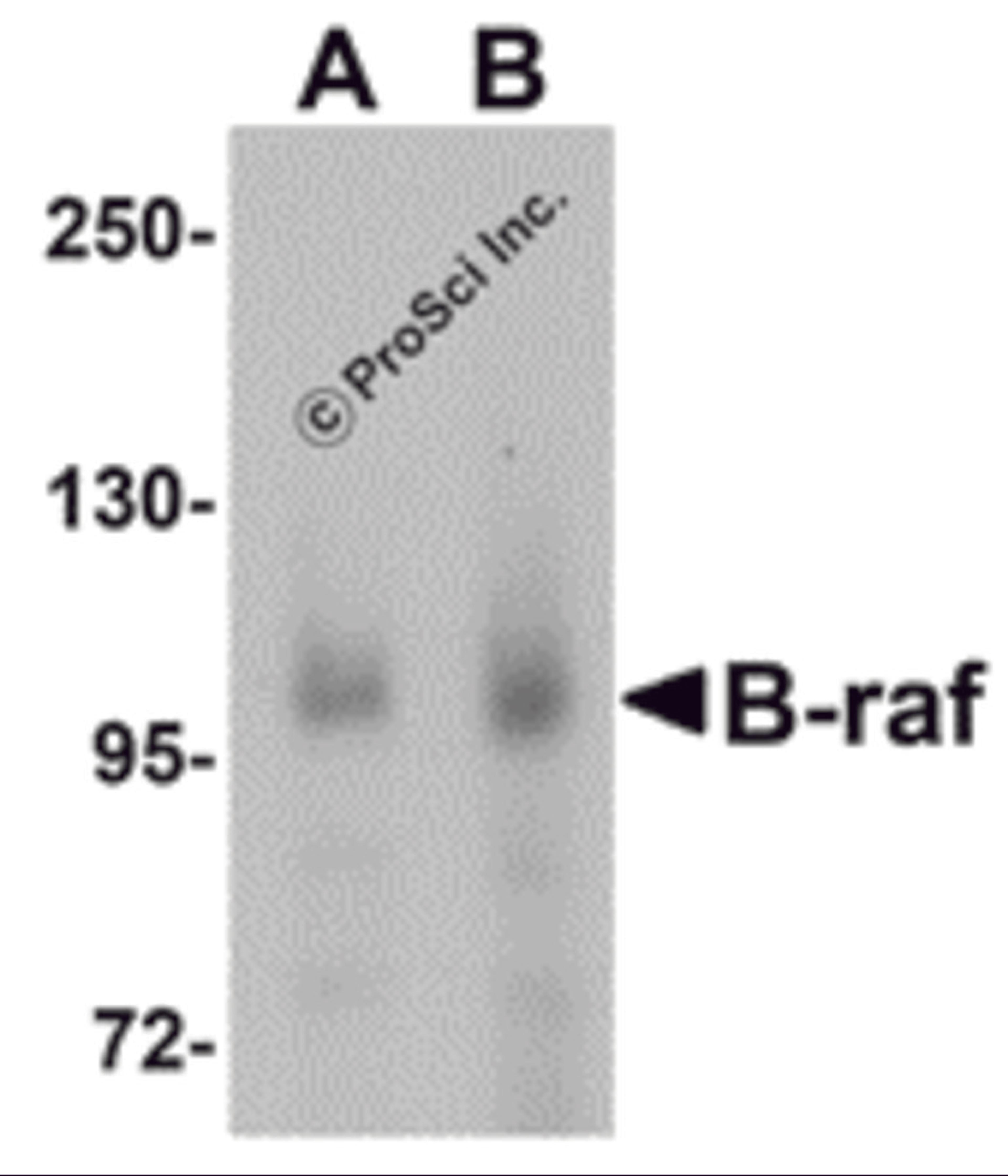 Western blot analysis of B-raf in human brain tissue lysate with B-raf antibody at (A) 1 and (B) 2 &#956;g/mL.