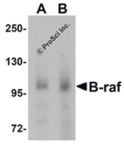 Western blot analysis of B-raf in human brain tissue lysate with B-raf antibody at (A) 1 and (B) 2 μg/mL.