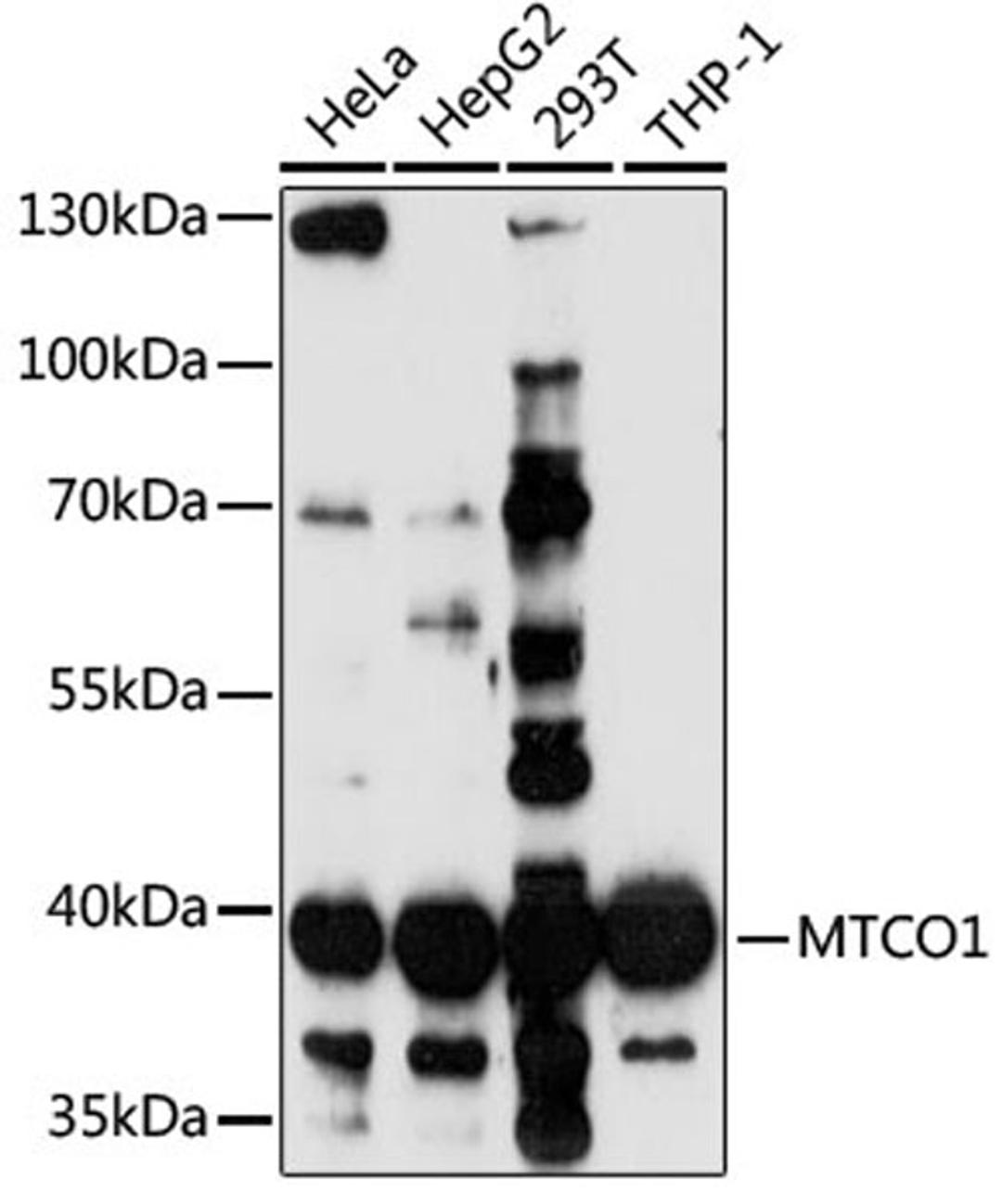 Western blot - MTCO1 antibody (A17889)