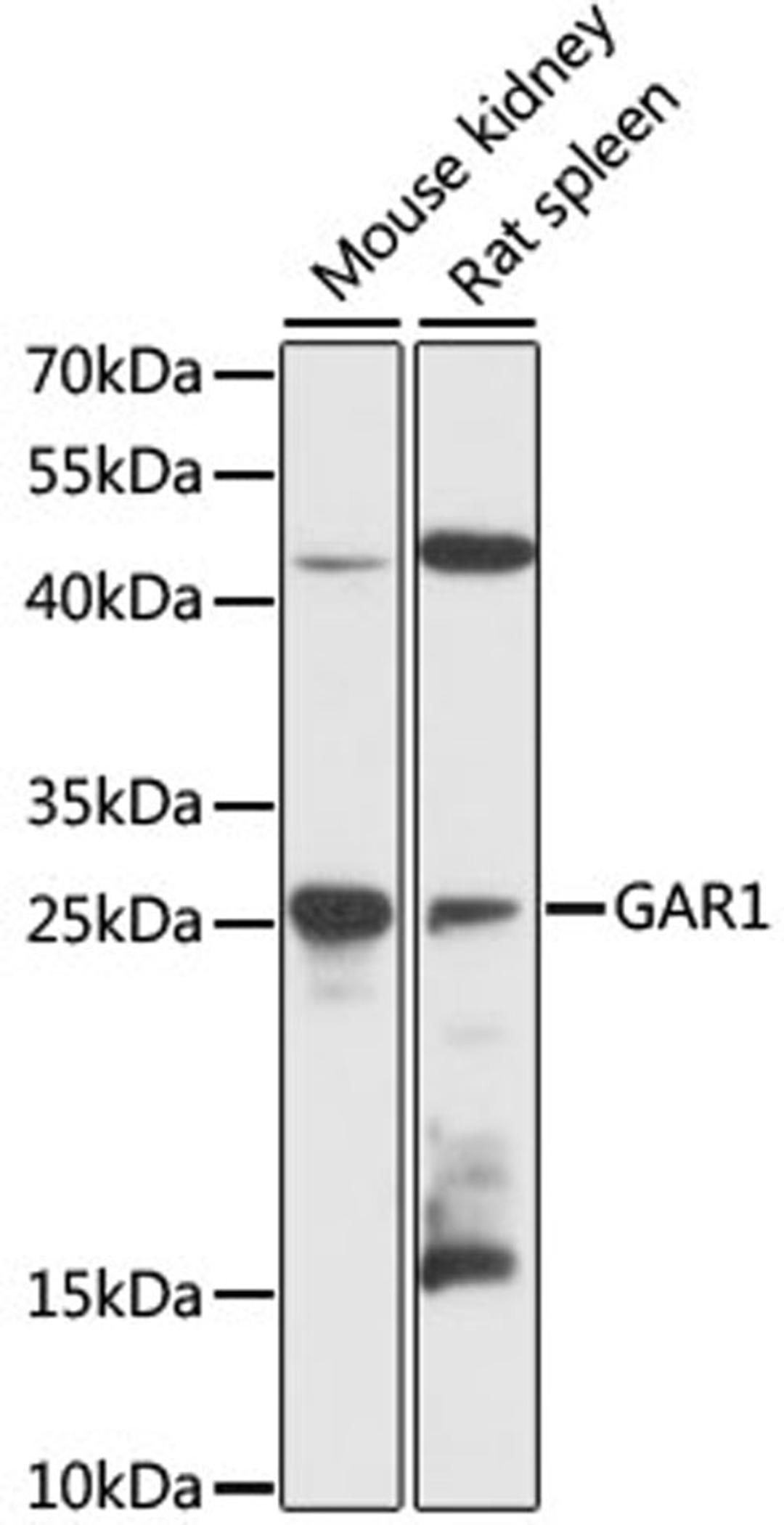 Western blot - GAR1 antibody (A12748)