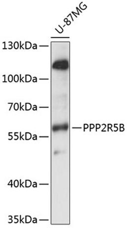 Western blot - PPP2R5B antibody (A14252)