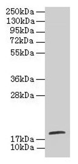 Western blot. All lanes: TPPP2 antibody at 8µg/ml + HepG2 whole cell lysate. Secondary. Goat polyclonal to rabbit IgG at 1/10000 dilution. Predicted band size: 19 kDa. Observed band size: 19 kDa