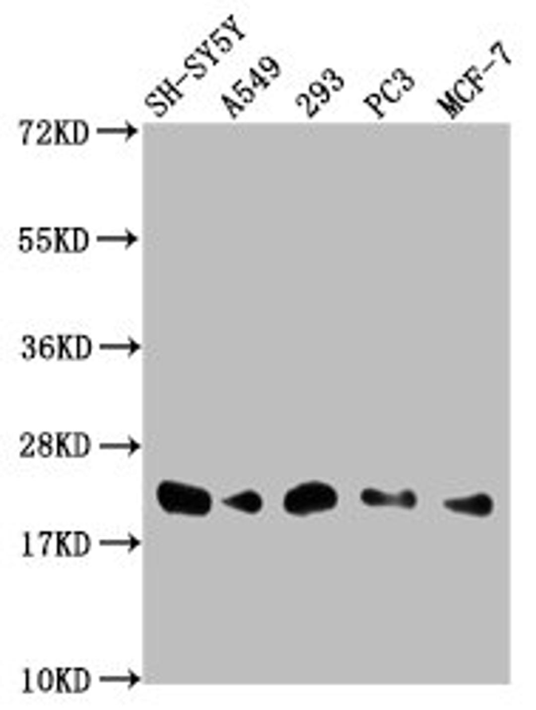 Western Blot. Positive WB detected in: SH-SY5Y whole cell lysate, A549 whole cell lysate, 293 whole cell lysate, PC-3 whole cell lysate, MCF-7 whole cell lysate. All lanes: ITGB1BP1 antibody at 1:2000. Secondary. Goat polyclonal to rabbit IgG at 1/50000 dilution. Predicted band size: 22, 17 kDa. Observed band size: 22 kDa